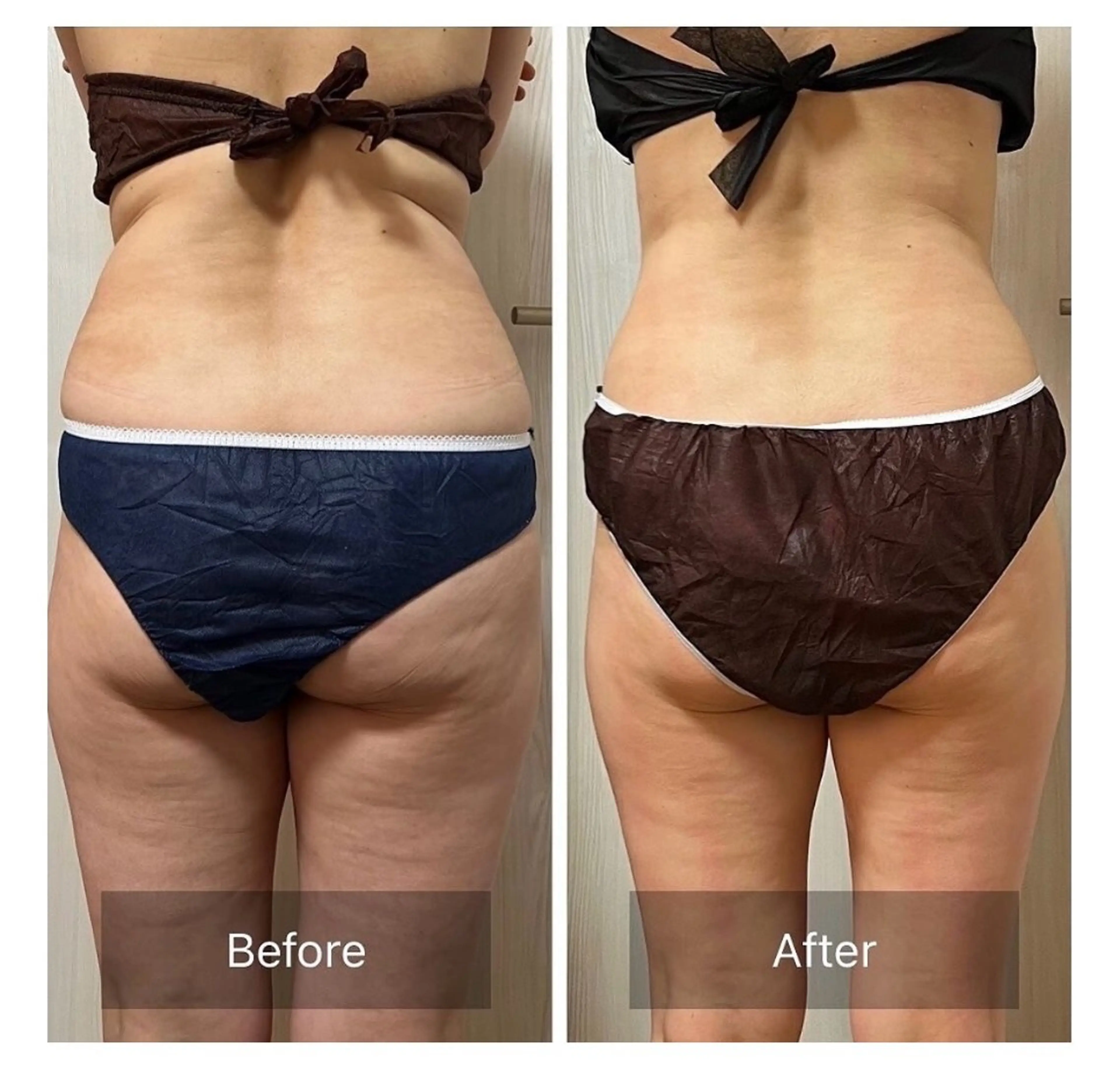 Raviy(A.) 【痩身・韓国肌管理】のエステ・リラクイメージ