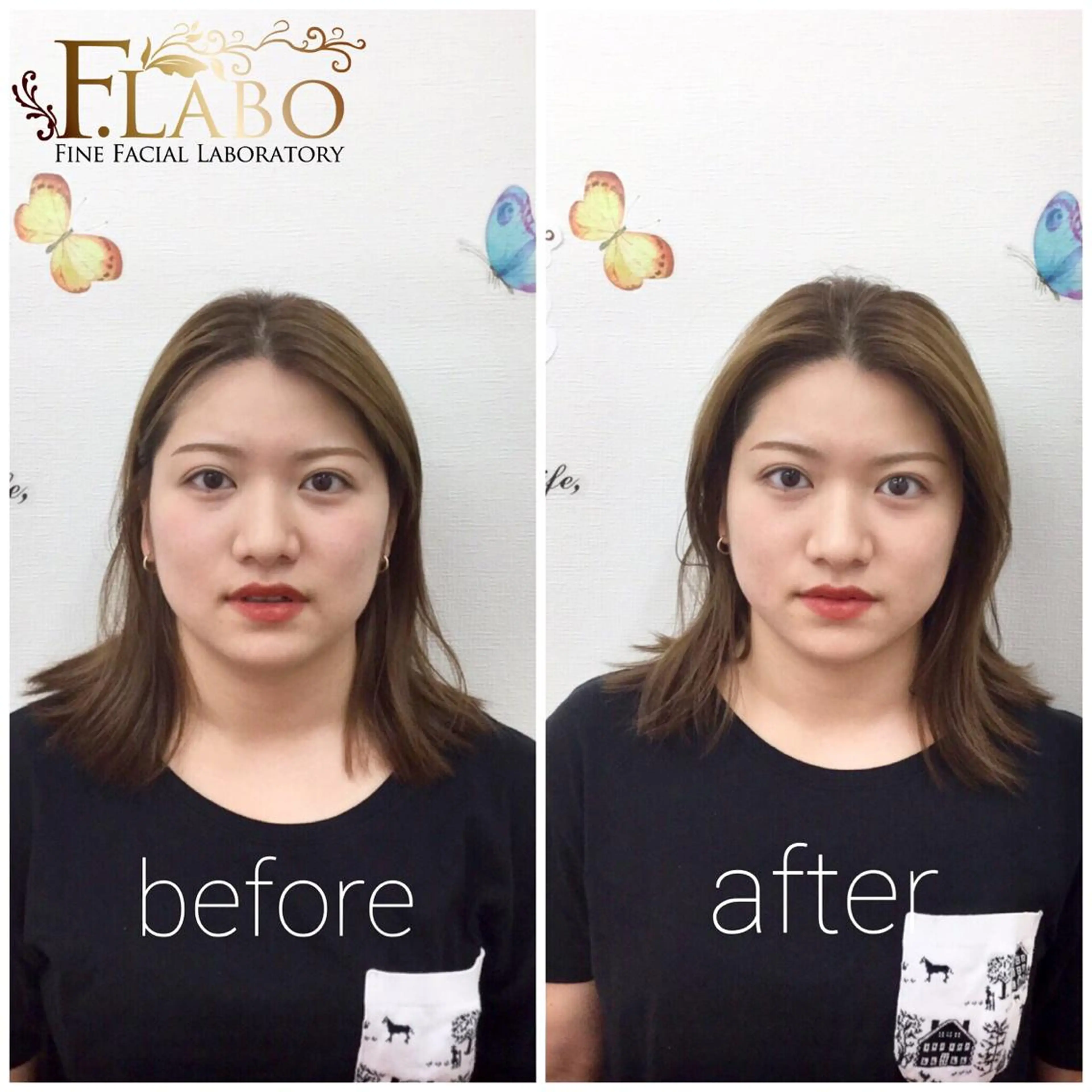 小顔&ダイエットジム エステ担当REIKOのその他イメージ