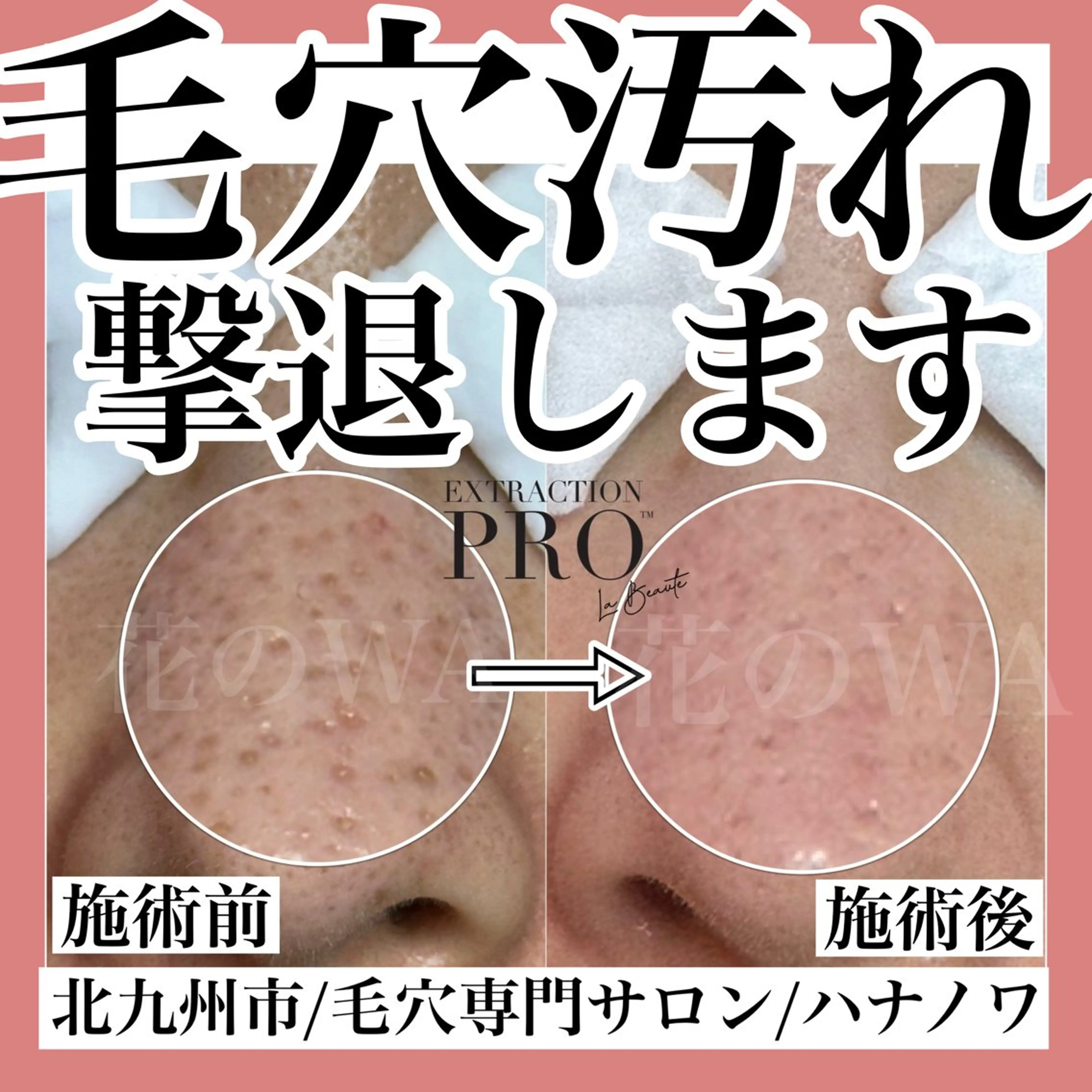 エステ リラク 毛穴&リンパマッサー ジ専門サロン花のWAのエステ・リラクイメージ