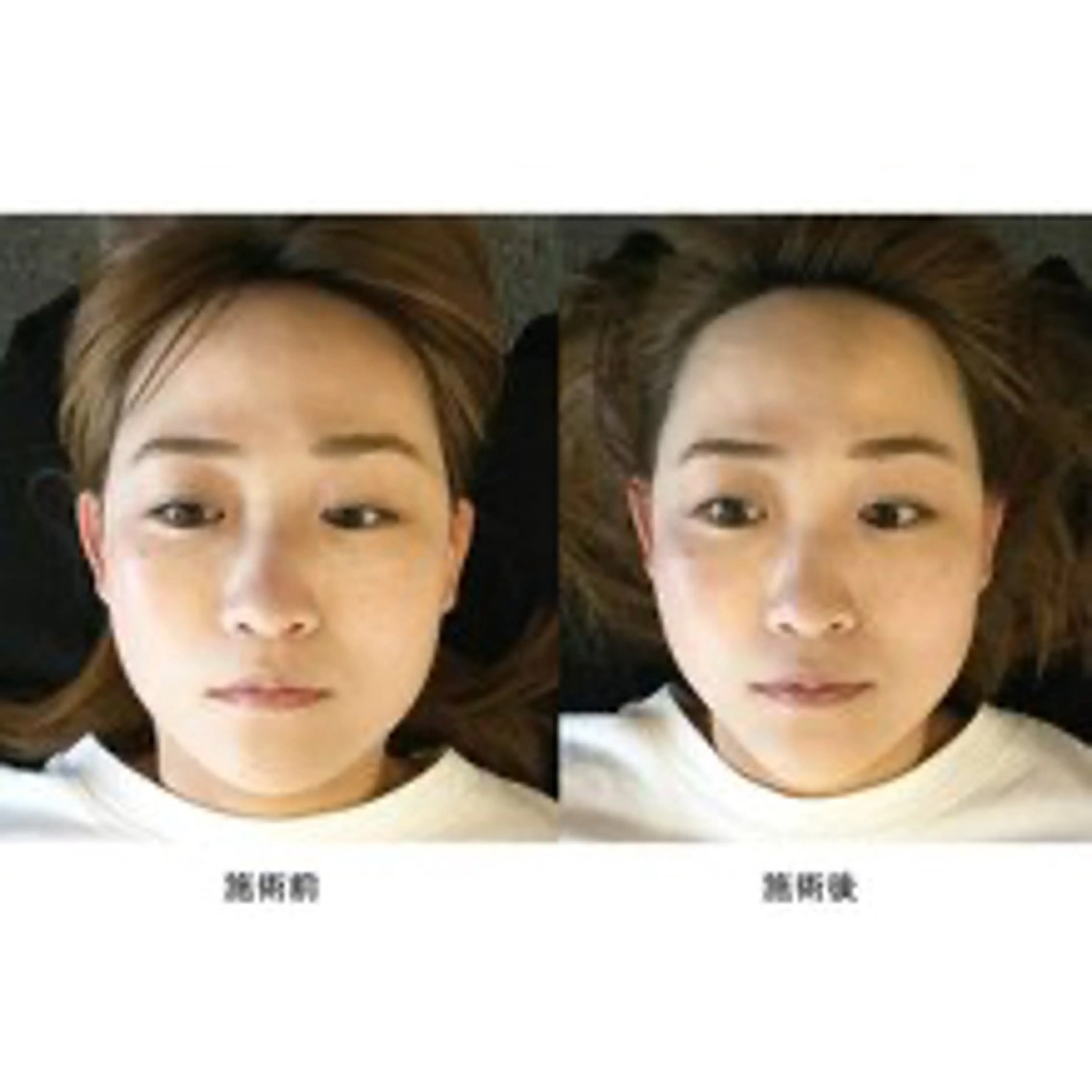 〖お写真を撮らせて下さる方限定〗しっかり引き上げ!頭蓋骨矯正60分の写真