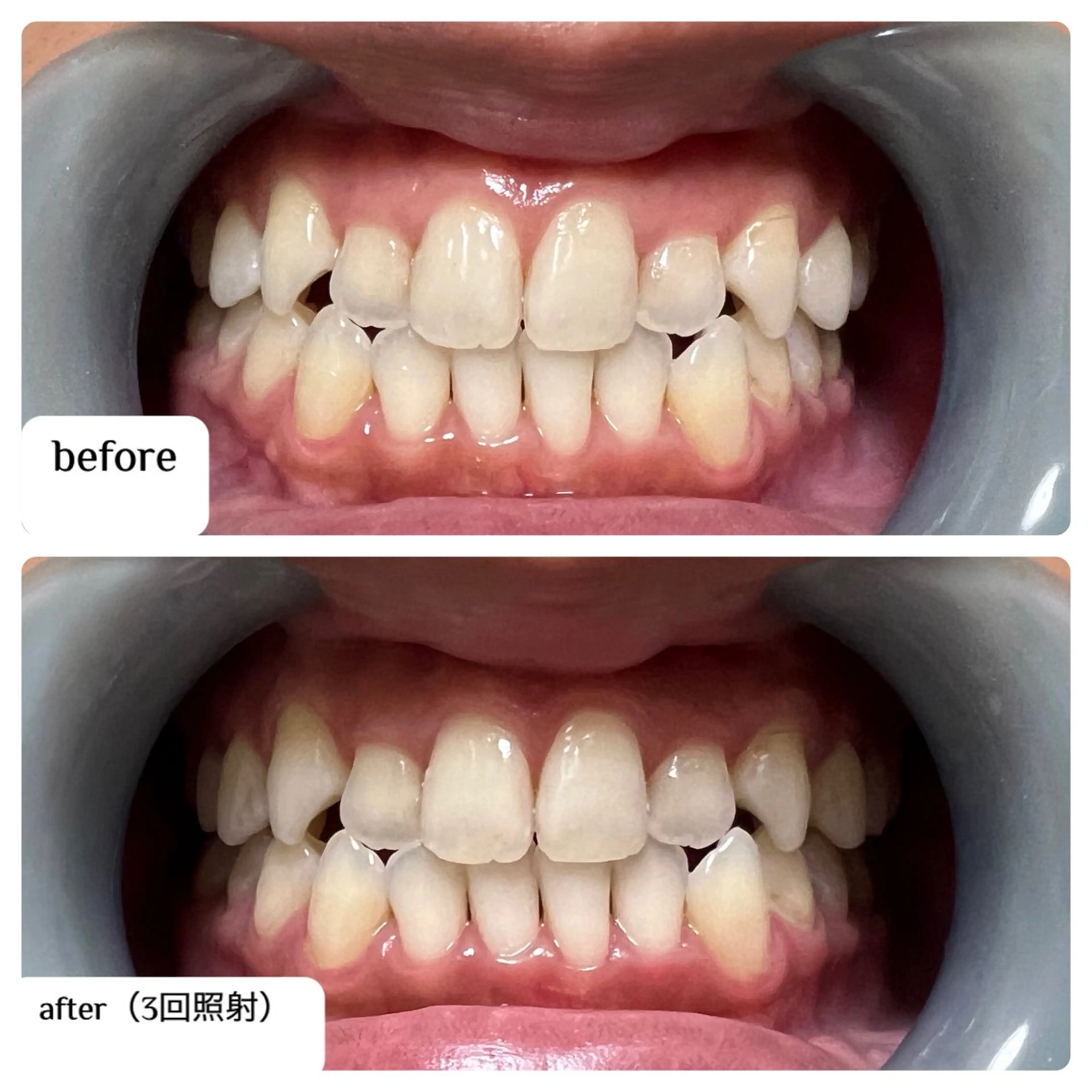 Akala miのエステ・リラクイメージ