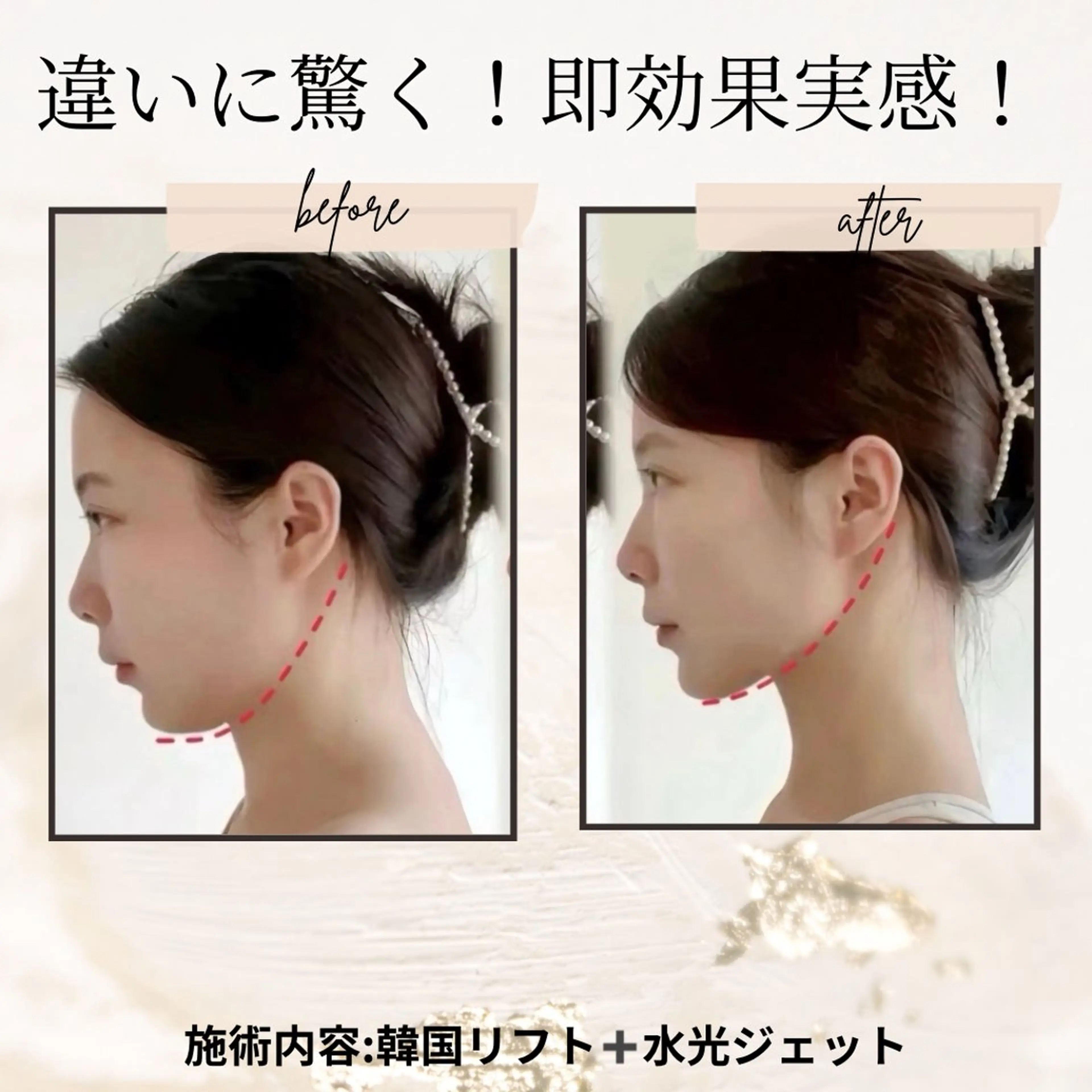 エステ リラク 愛維美水光美肌専門店 メンズレディースokのエステ・リラクイメージ