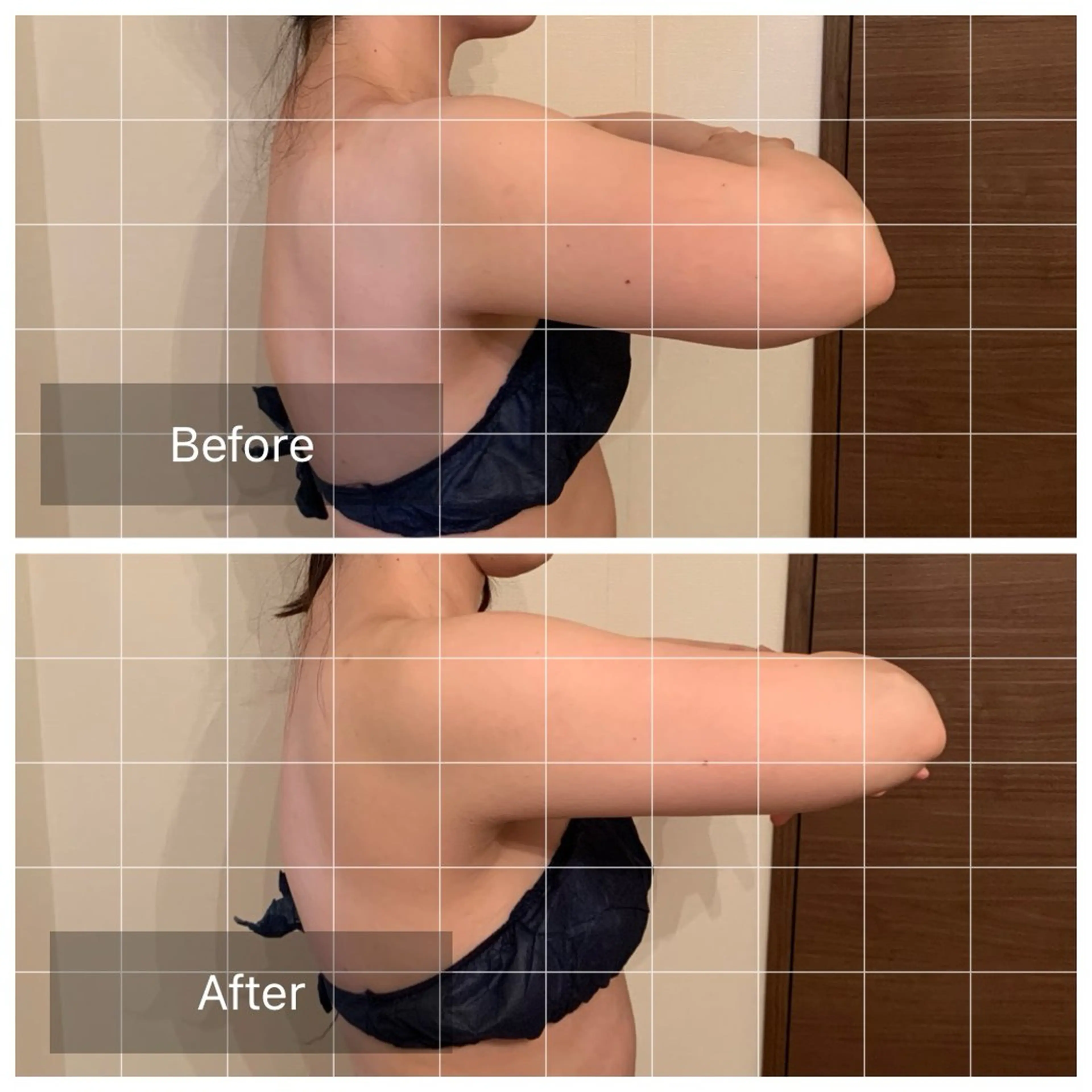 小顔とシミケア🪽 /Salon Mのエステ・リラクイメージ