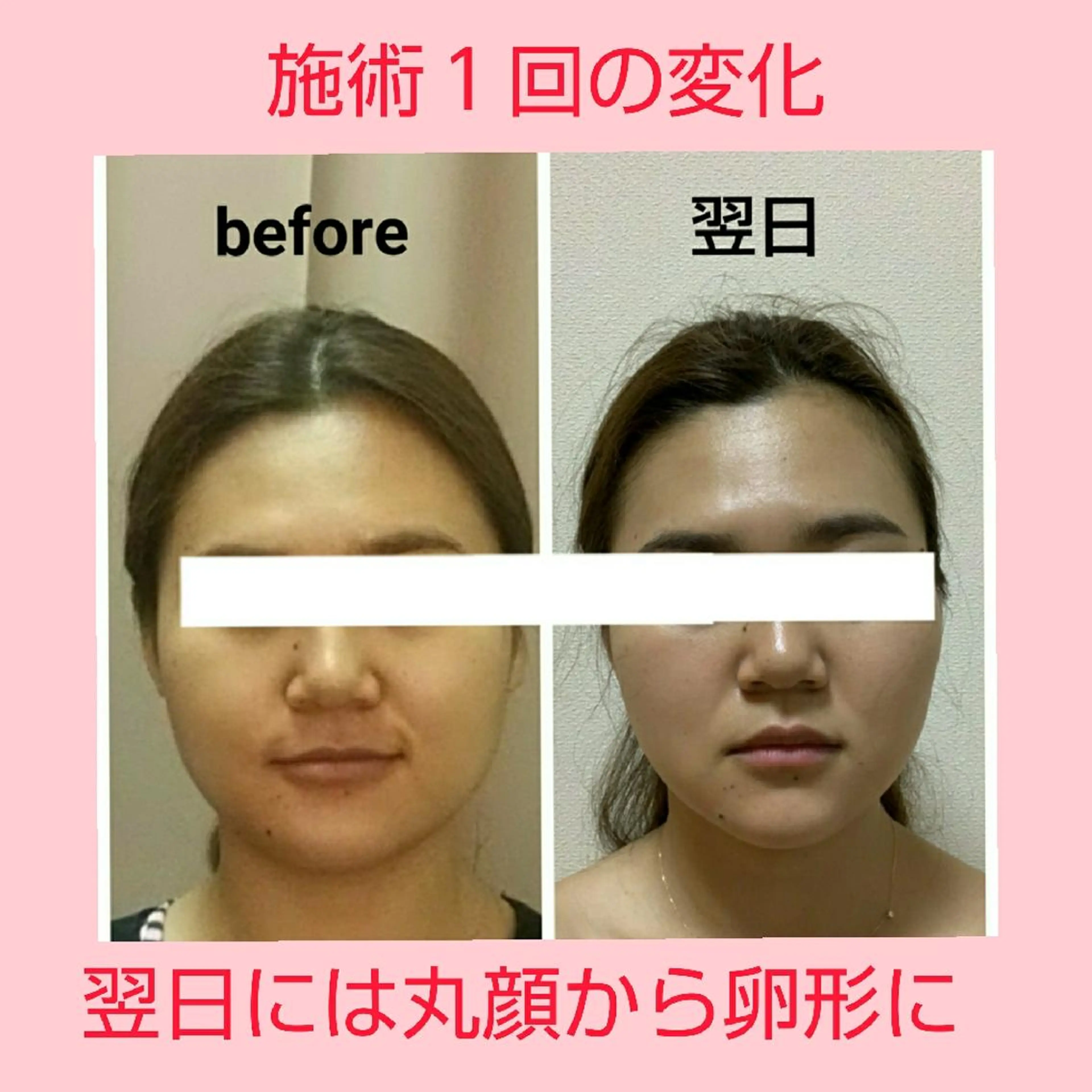 小顔 美肌専門 Matoriaのエステ・リラクイメージ