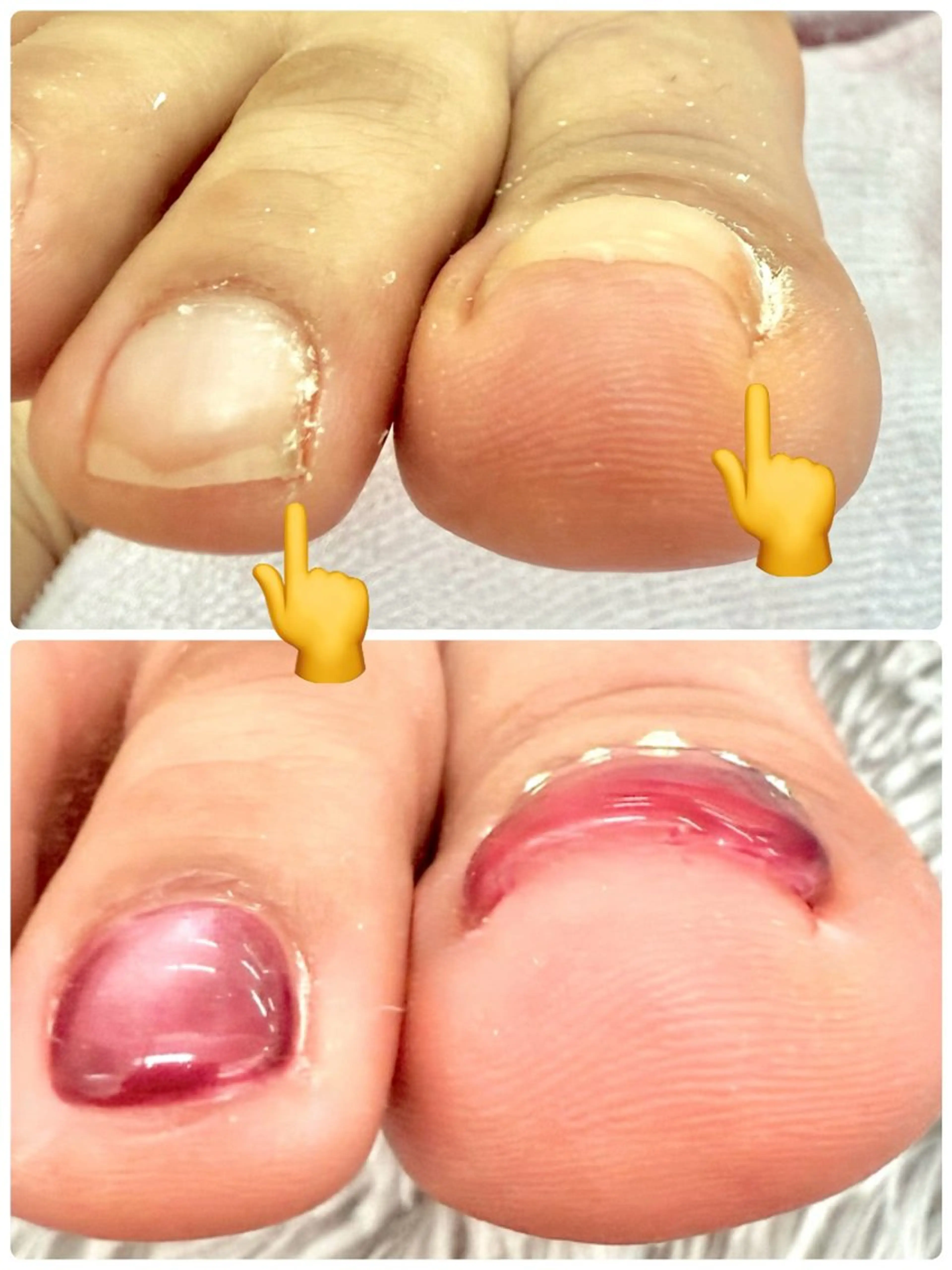 ネイル モナネイル ＡＩのネイルデザイン
