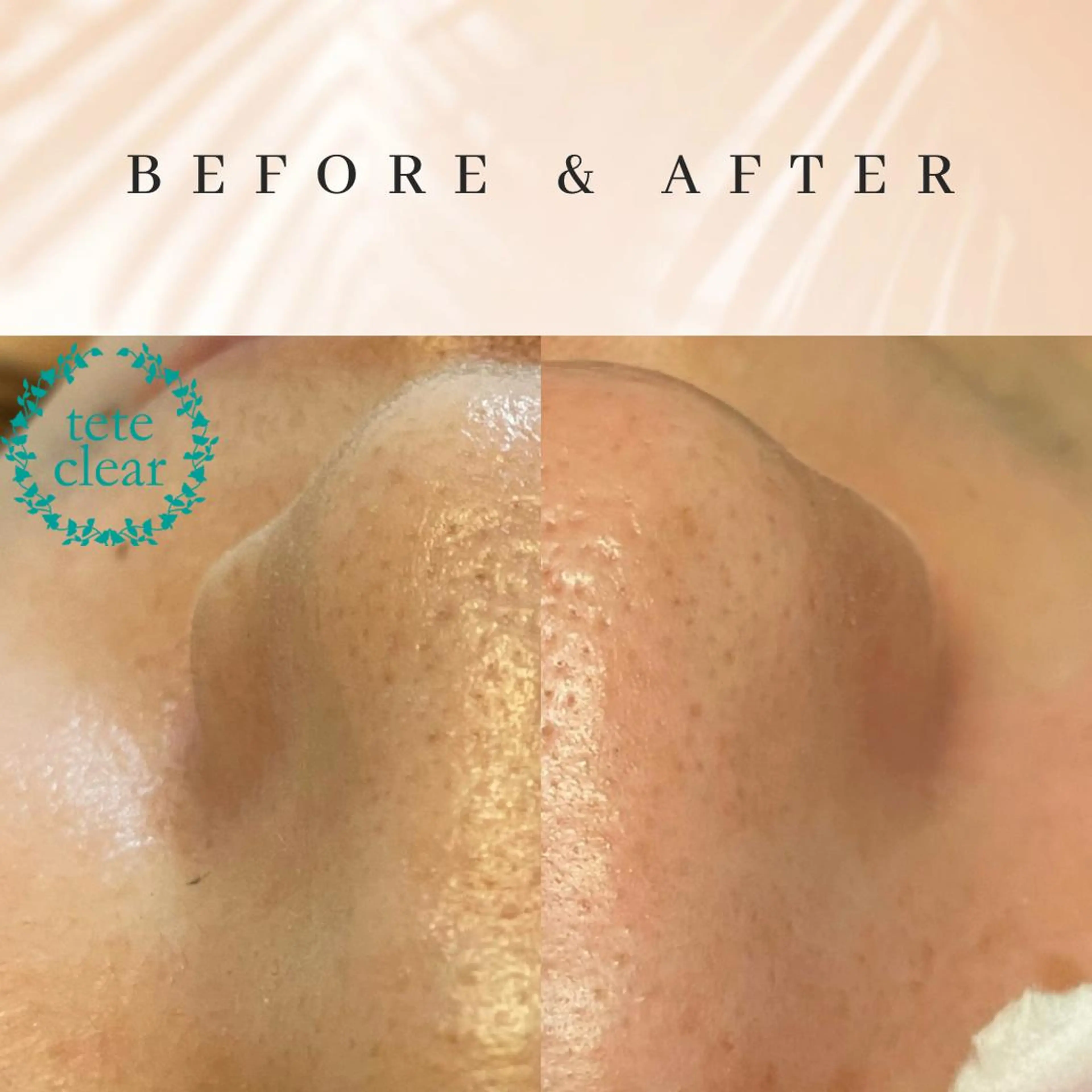 エステ リラク セルフエステエンリケ明石大久保店所属・夕希 毛穴と脱毛特化サロンのエステ・リラクイメージ