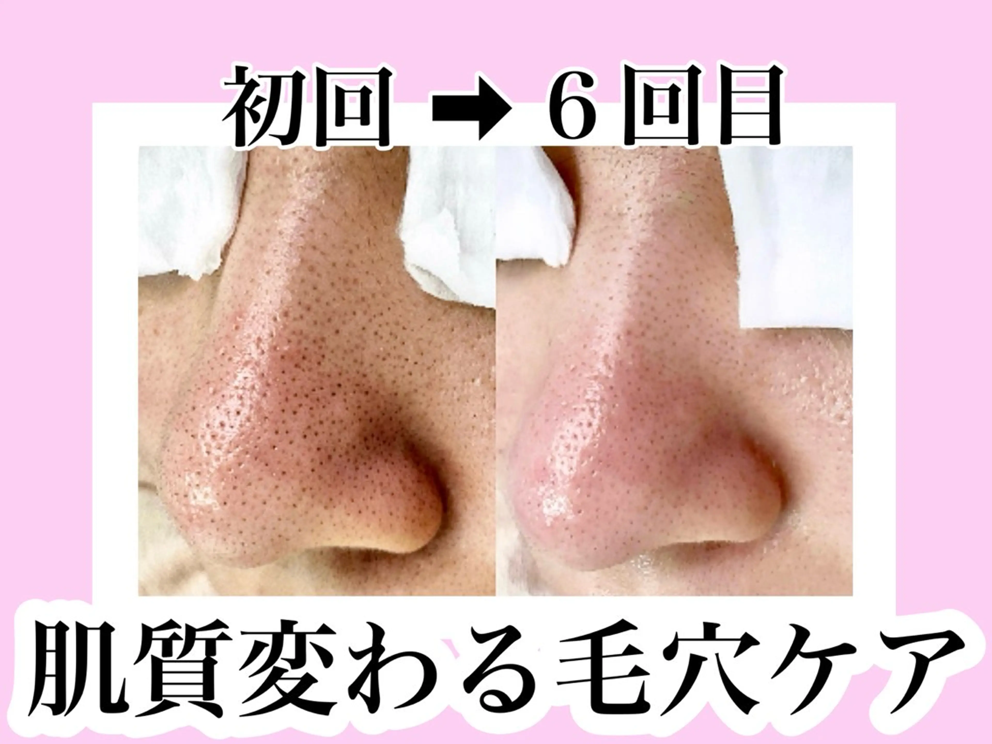 医療提携美容サロン Beatriceのエステ・リラクイメージ