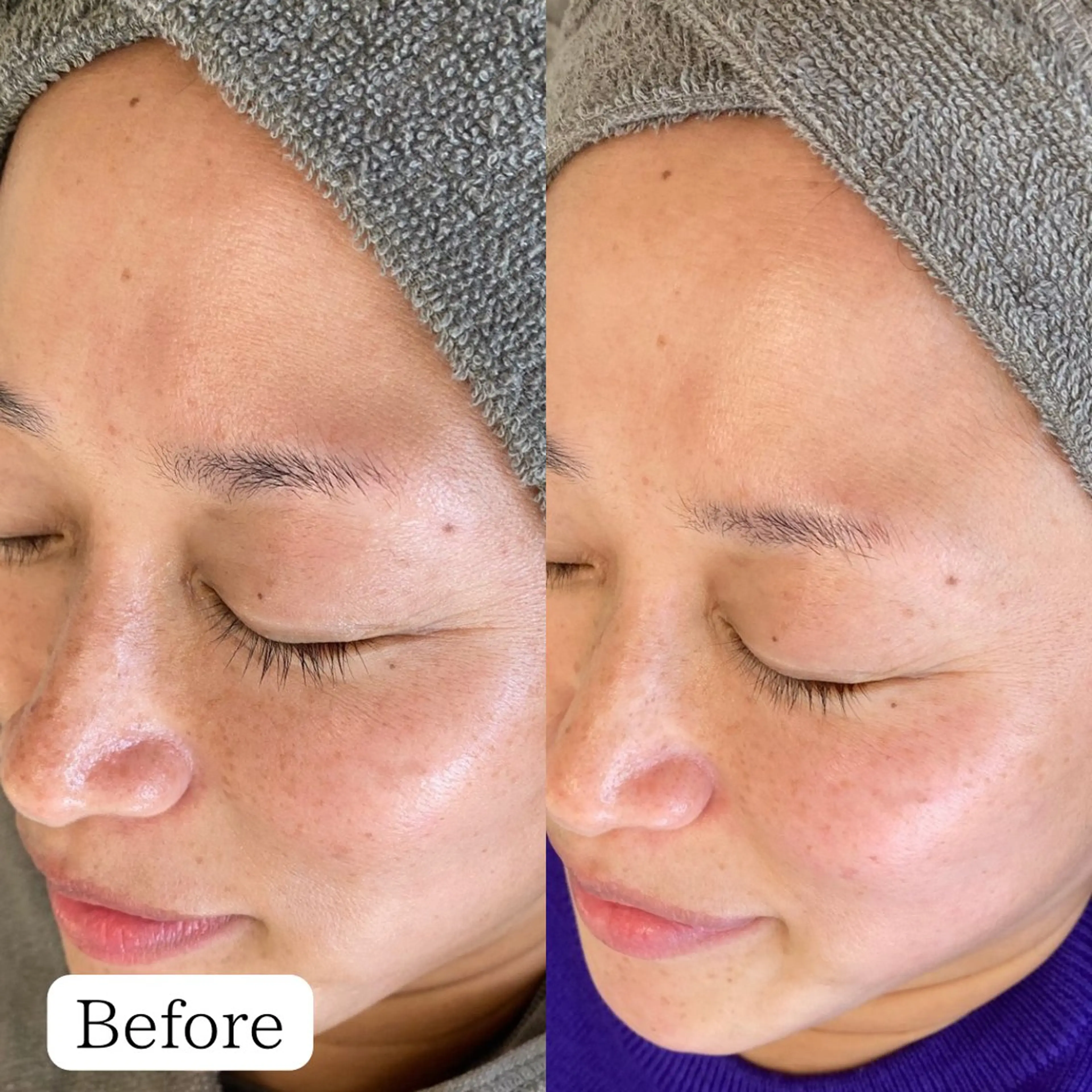 シミケア専門店 &More所属・シミケア専門店 &Moreのエステ・リラクイメージ