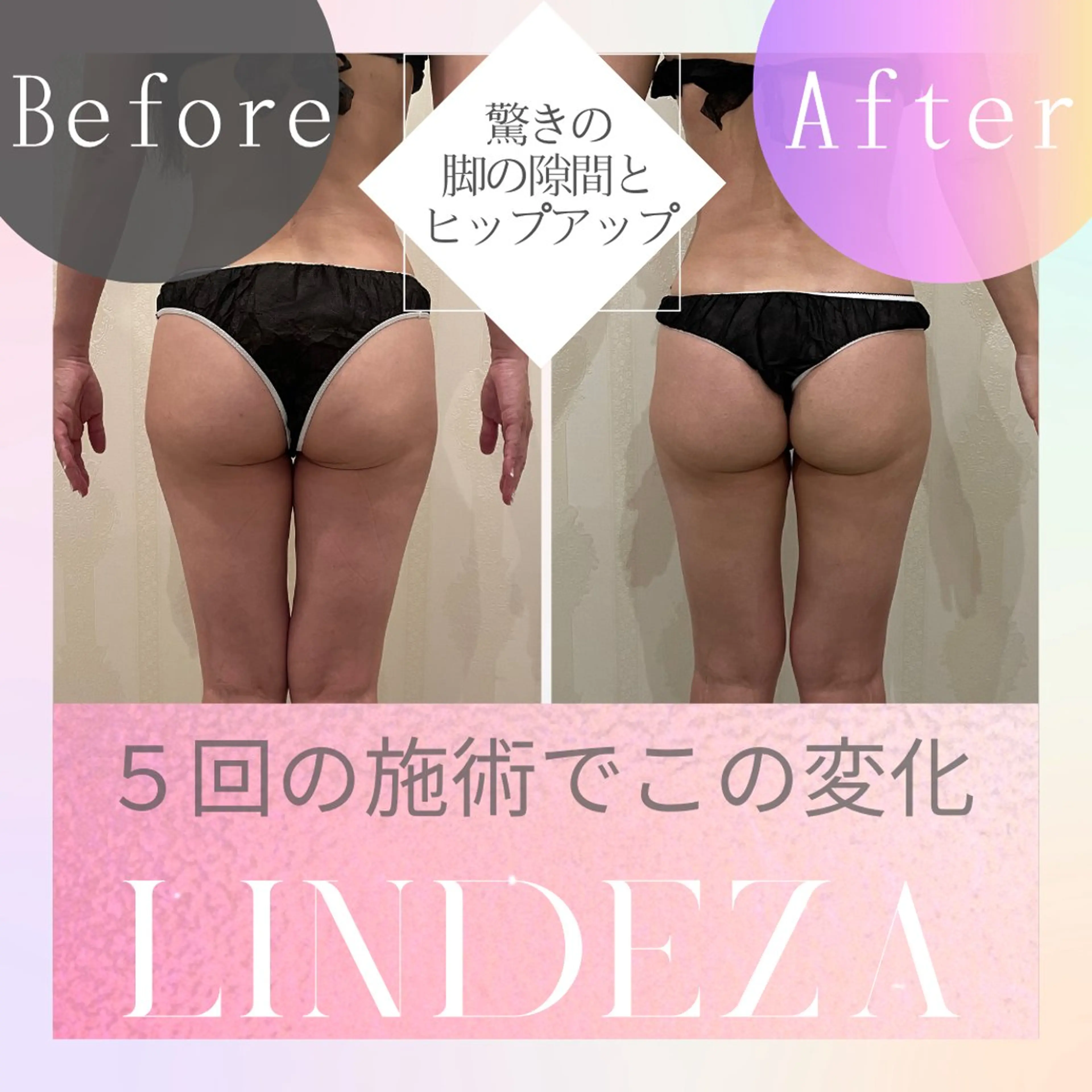 痩身【下半身ボディケア】の写真