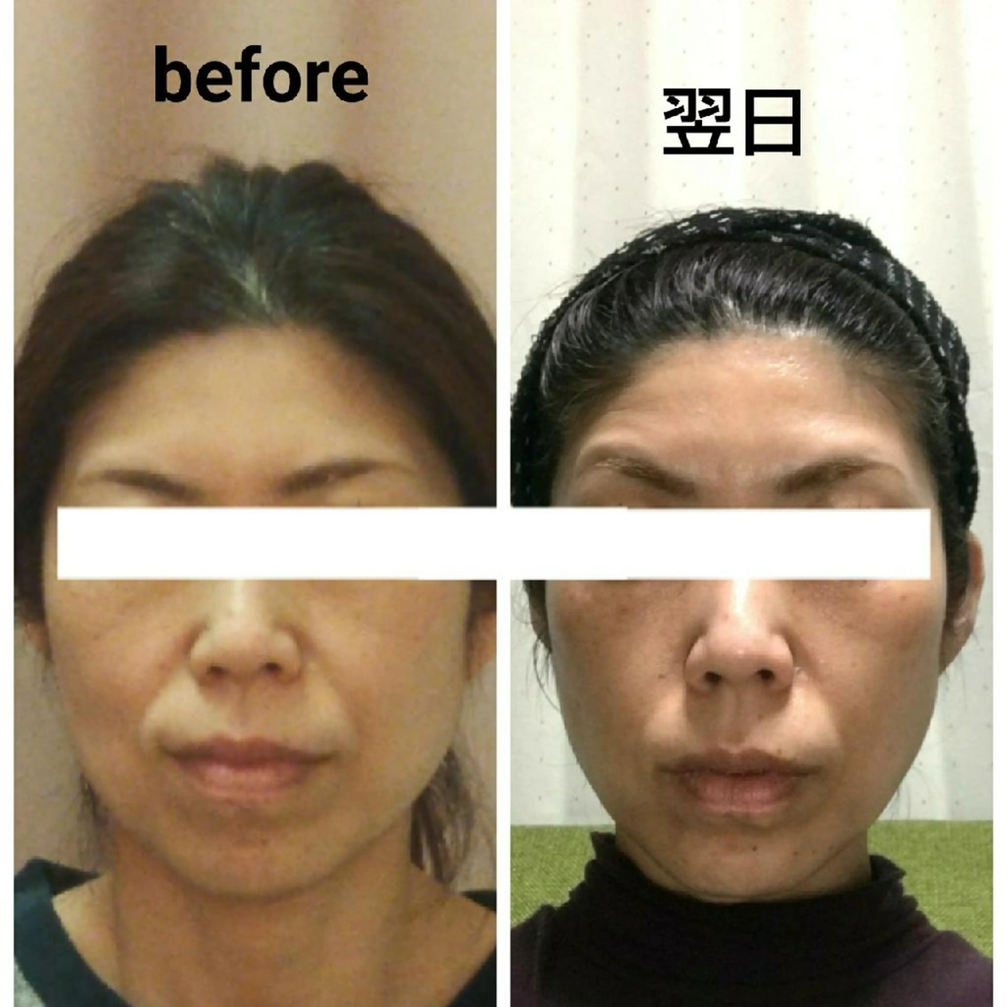 小顔 美肌専門 Matoriaのエステ・リラクイメージ