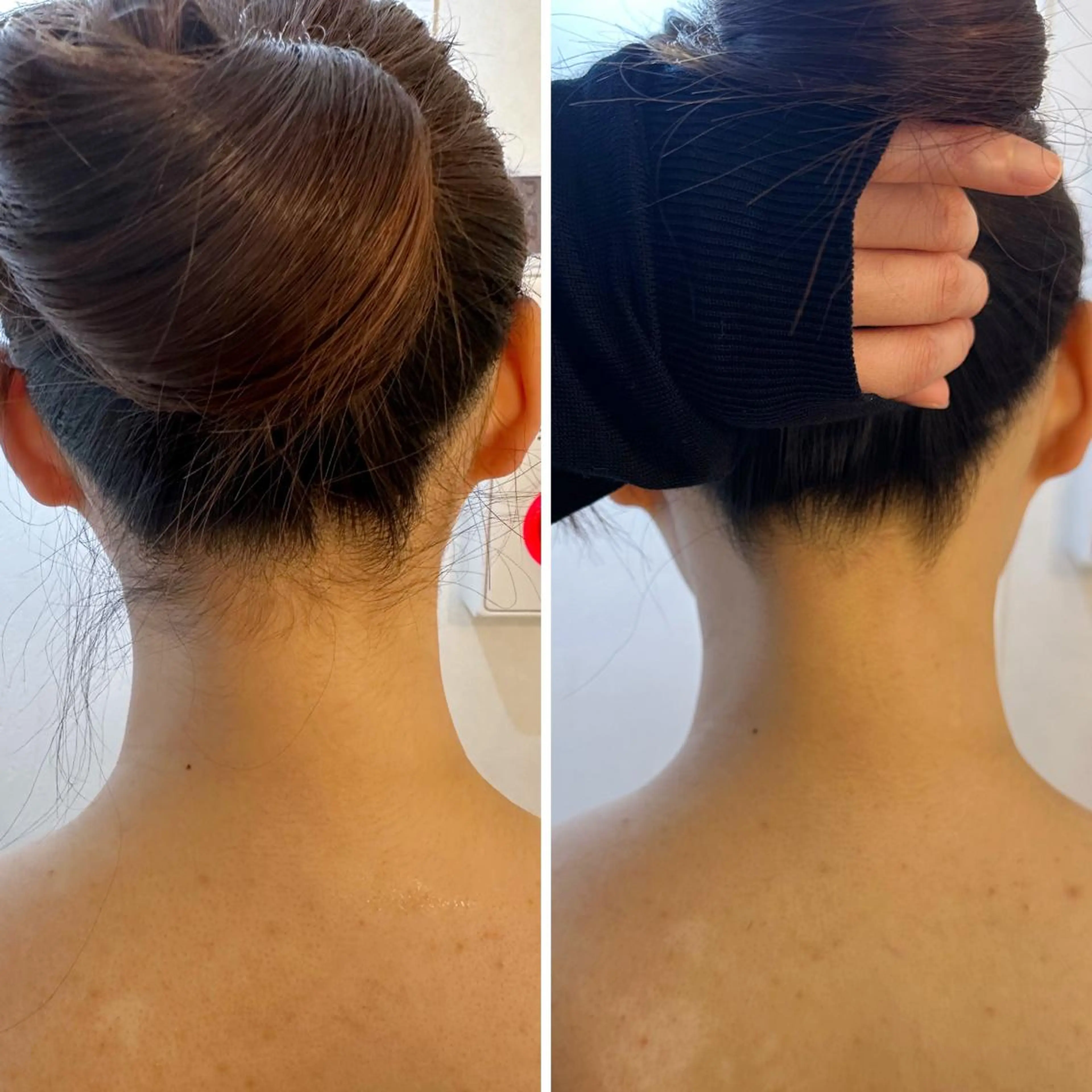 脱毛 うなじ脱毛/美肌脱毛 LABELのエステ・リラクイメージ