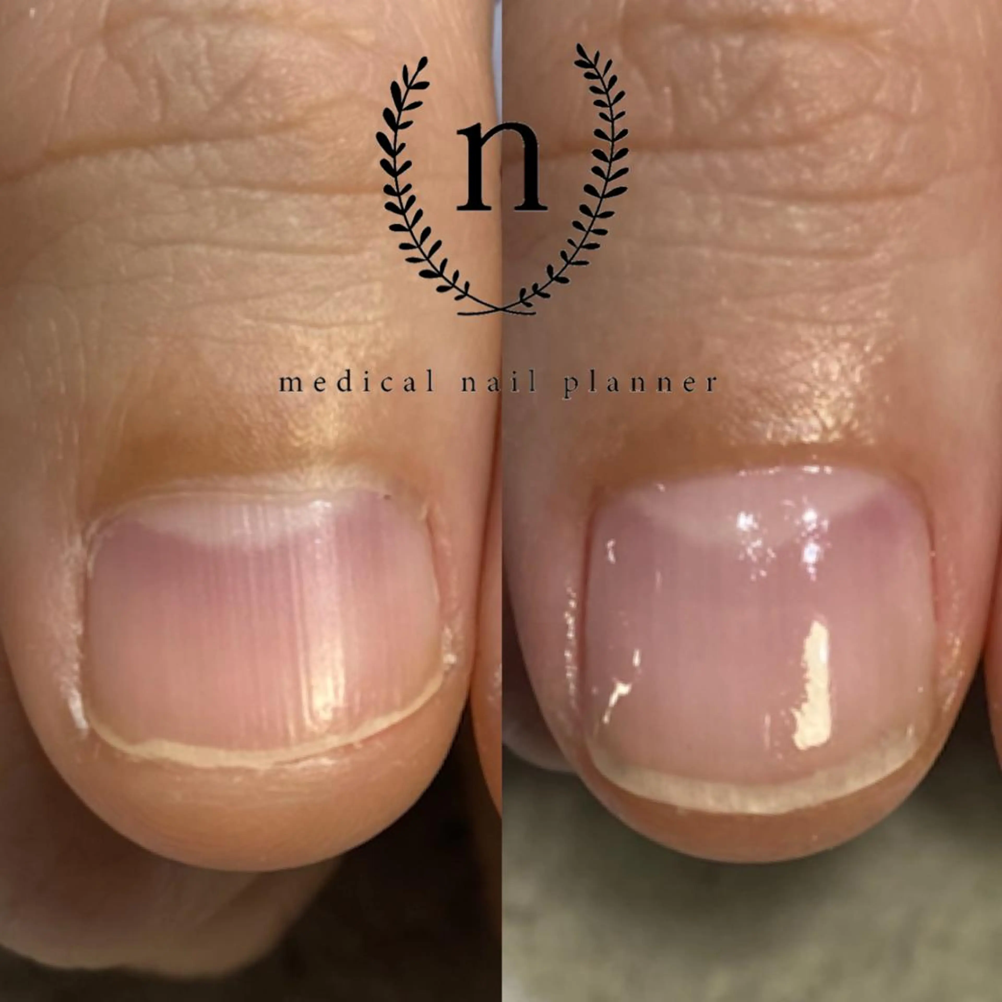 ネイル Rio 𓍼のネイルデザイン