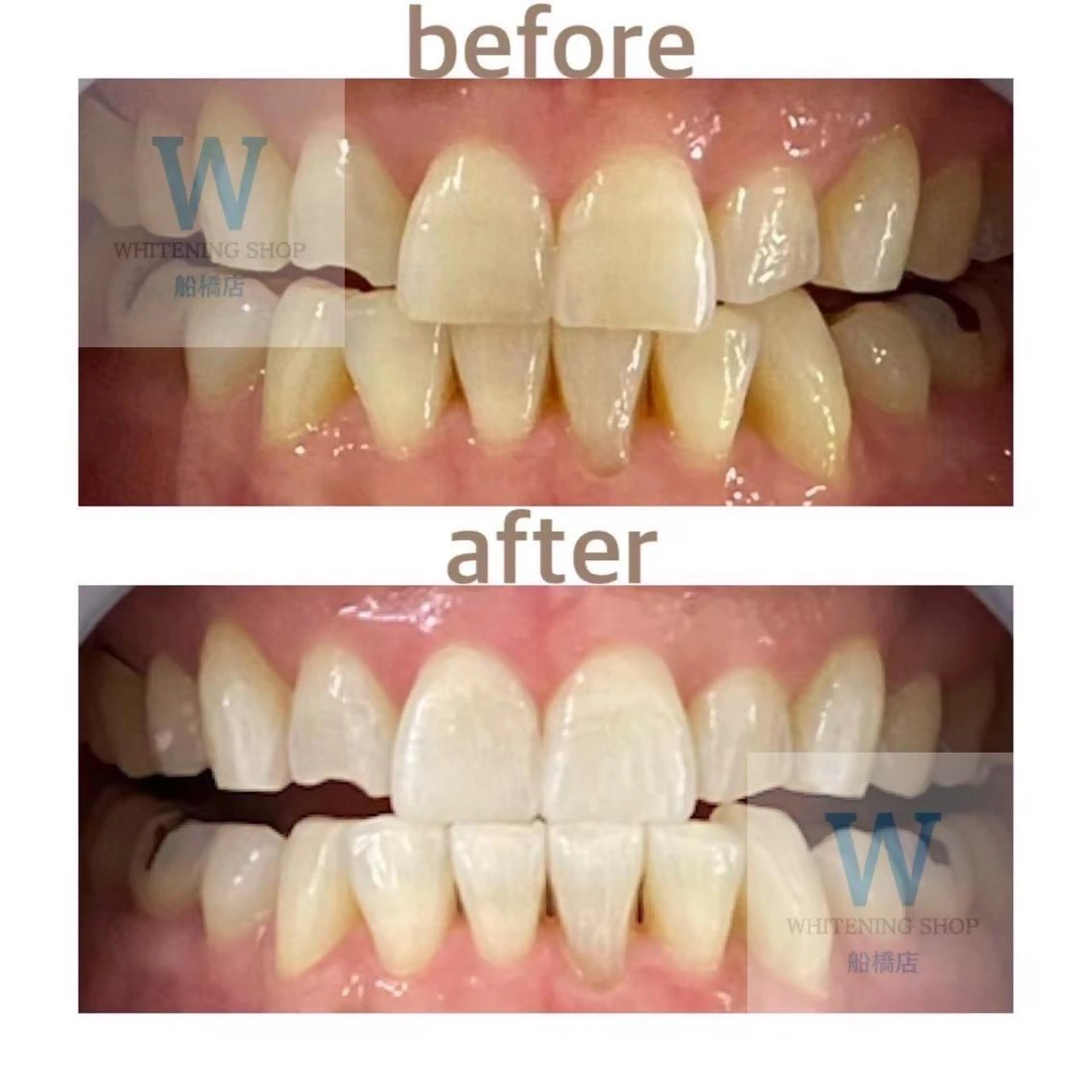 エステ リラク ホワイトニング ショップ船橋2号店のエステ・リラクイメージ