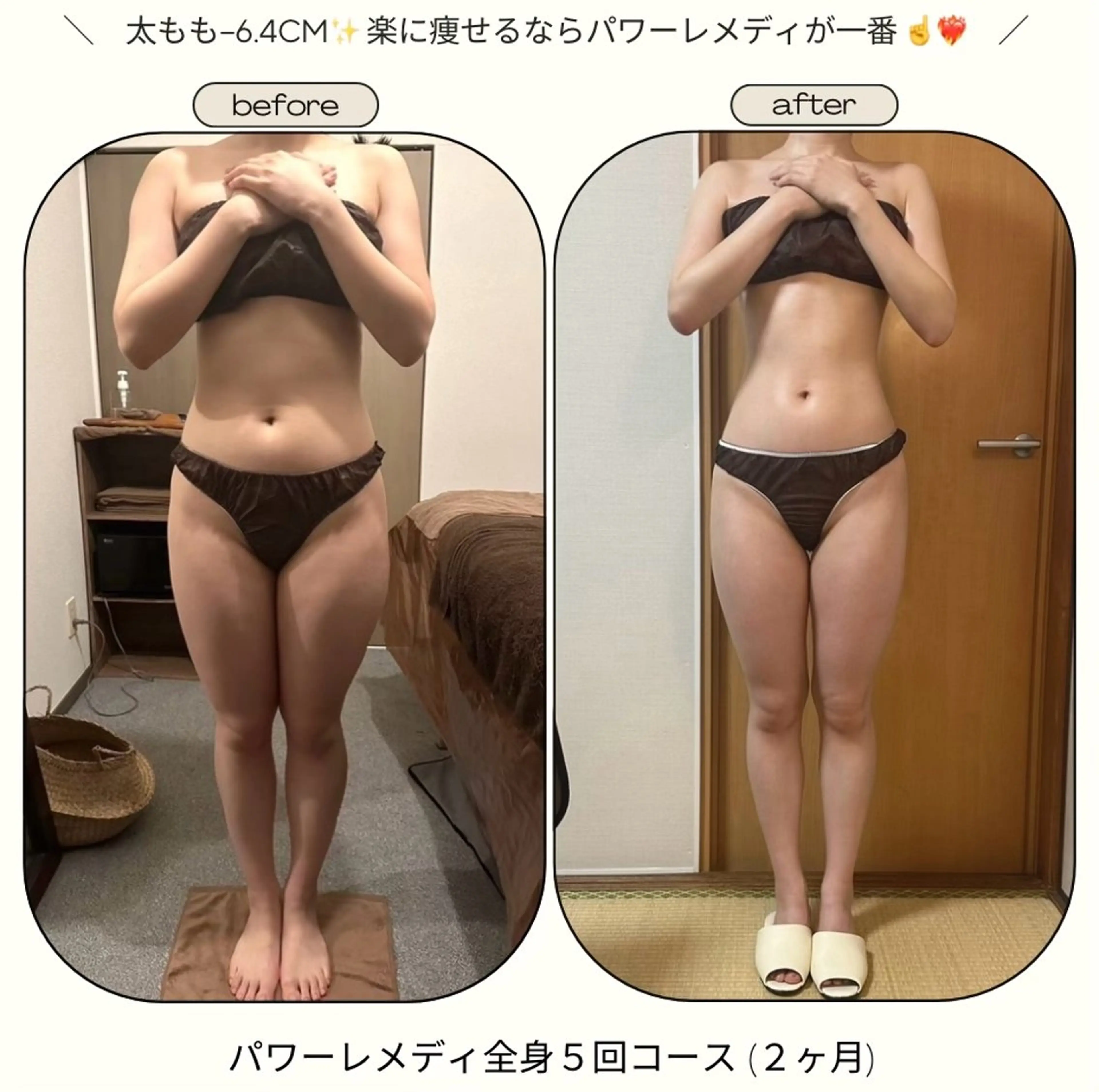 《本気痩せ×疲労改善 》  BILOOPのエステ・リラクイメージ