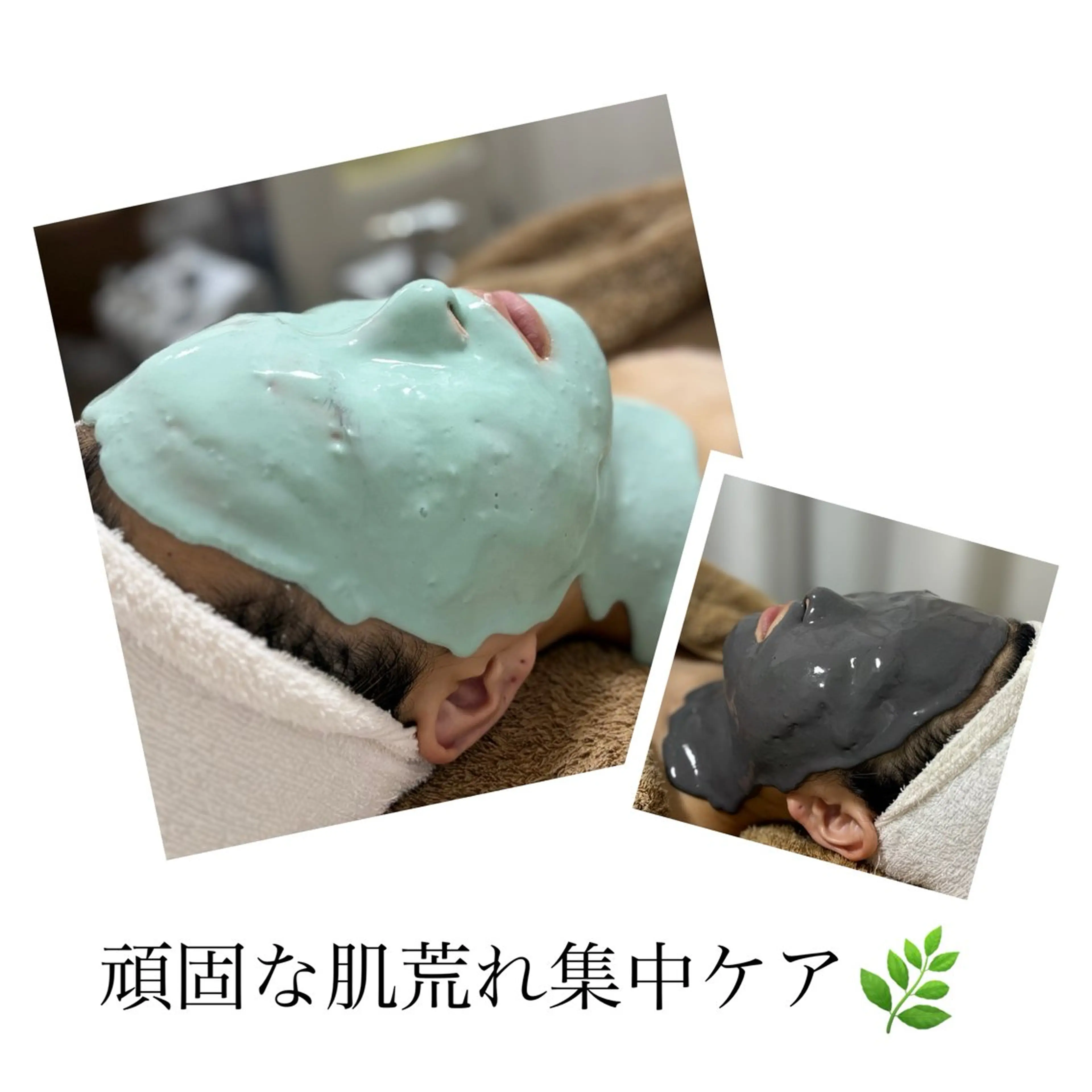 【悩める頑固な肌荒れ集中ケアコース💆🏻‍♀️✨】本格的な汚れ吸着＆鎮静のWケア🖤💚の写真