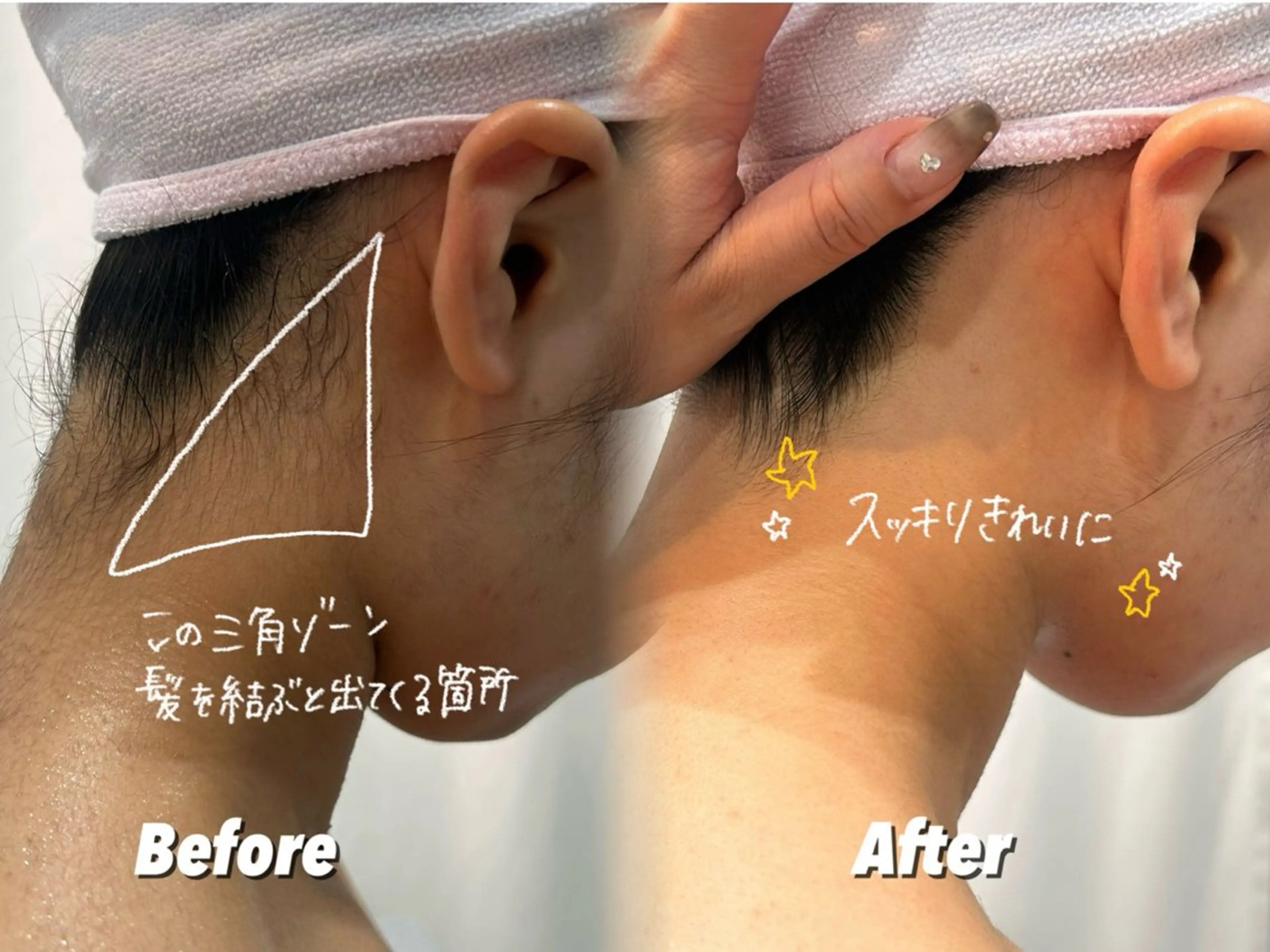 エステ 🫧美しい素肌へ🫧 今成柚乃のその他イメージ