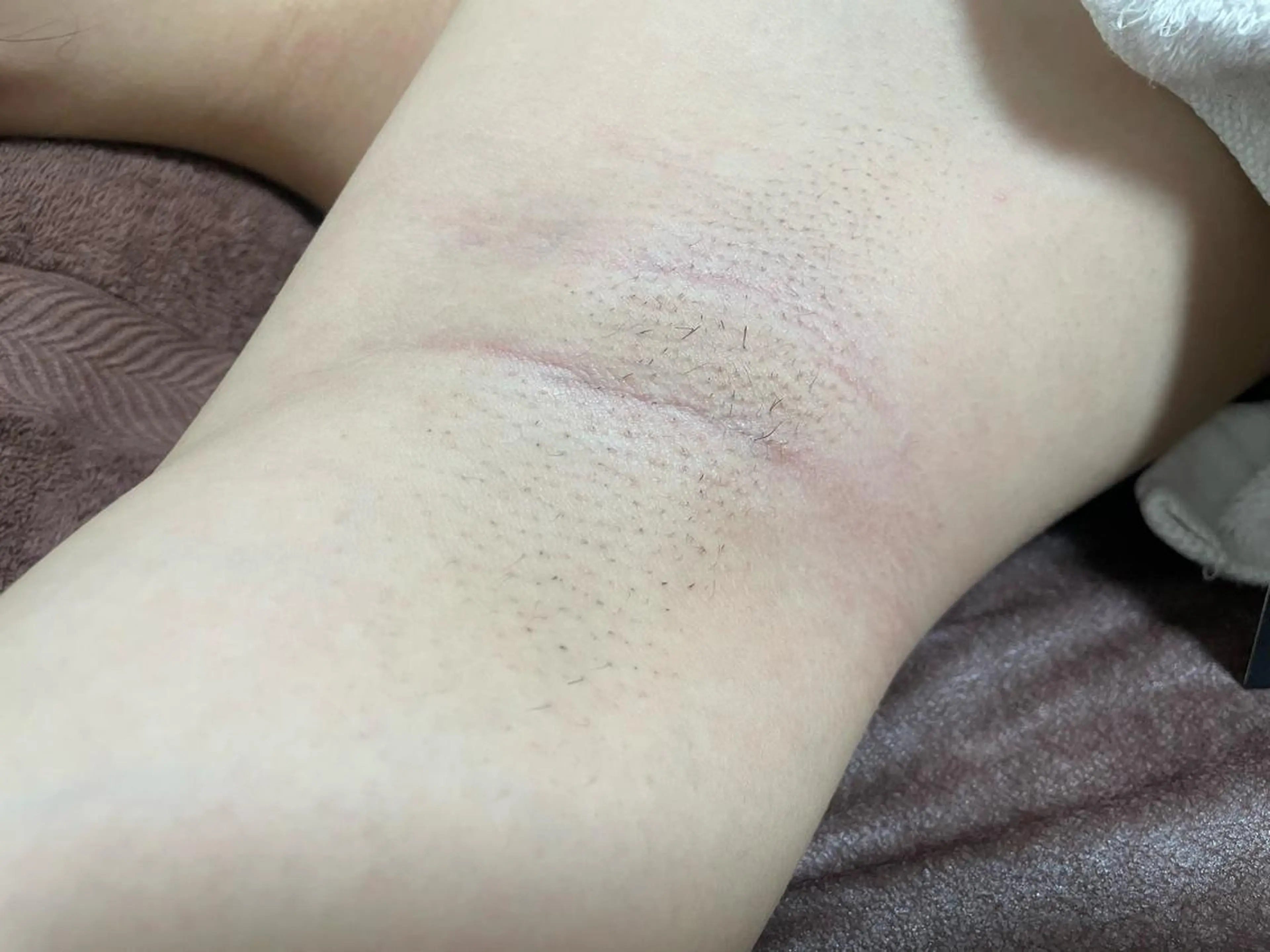 メンズ キッズ 脱毛SALON RaYNiCKのエステ・リラクイメージ