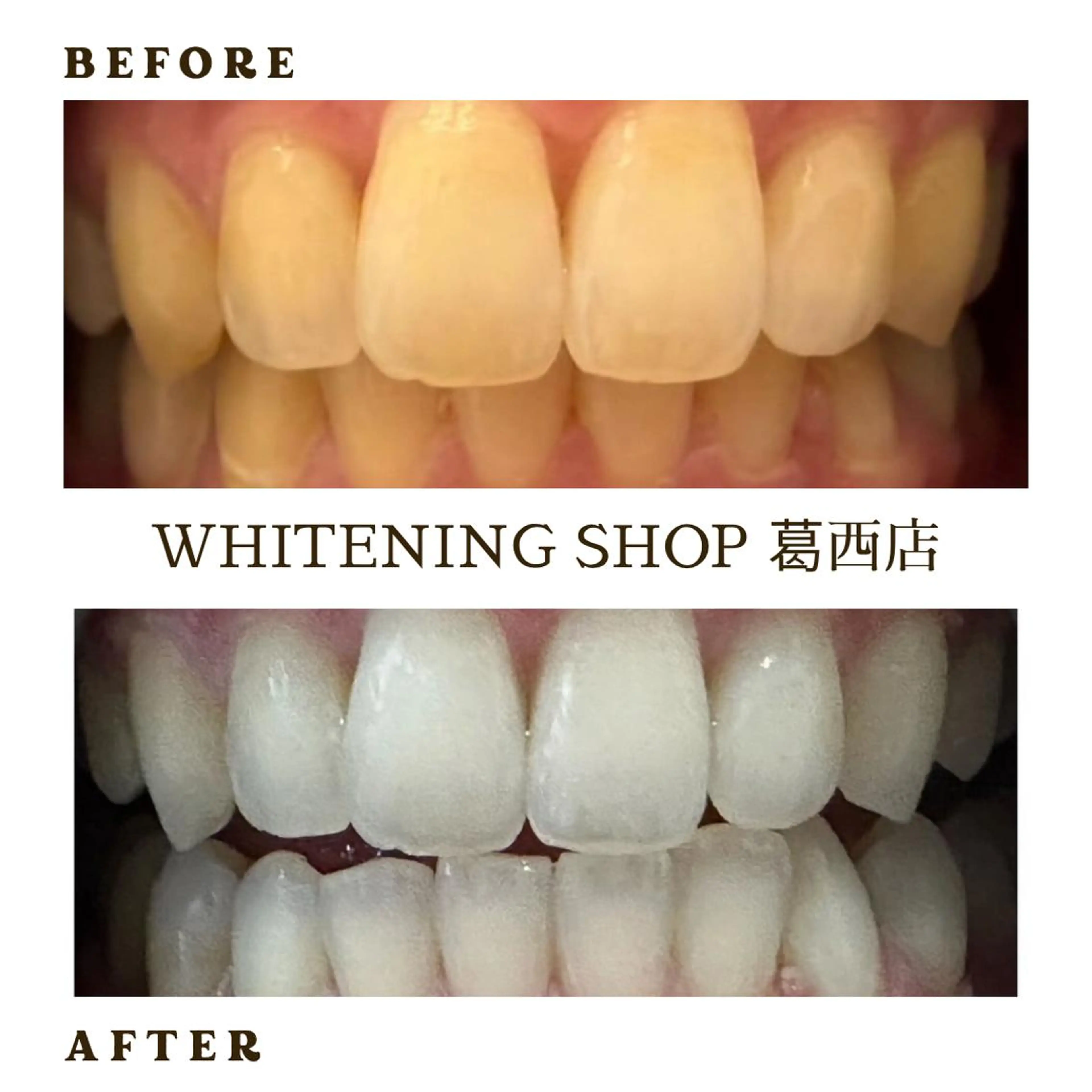 メンズ その他 ホワイトニング ショップ葛西店のその他イメージ