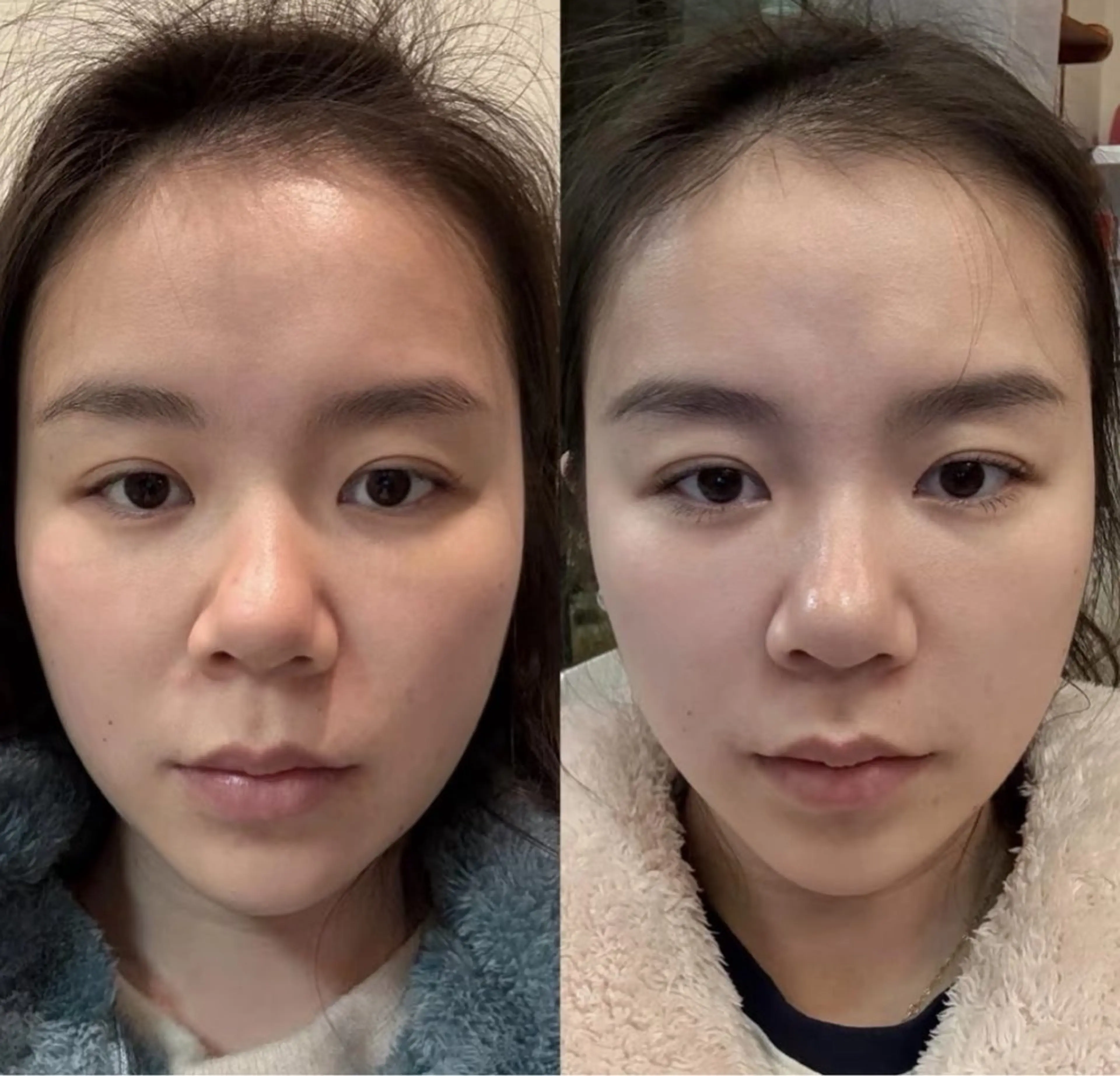 ネイル aliaハーブ水光店 エステティシャン募集のエステ・リラクイメージ