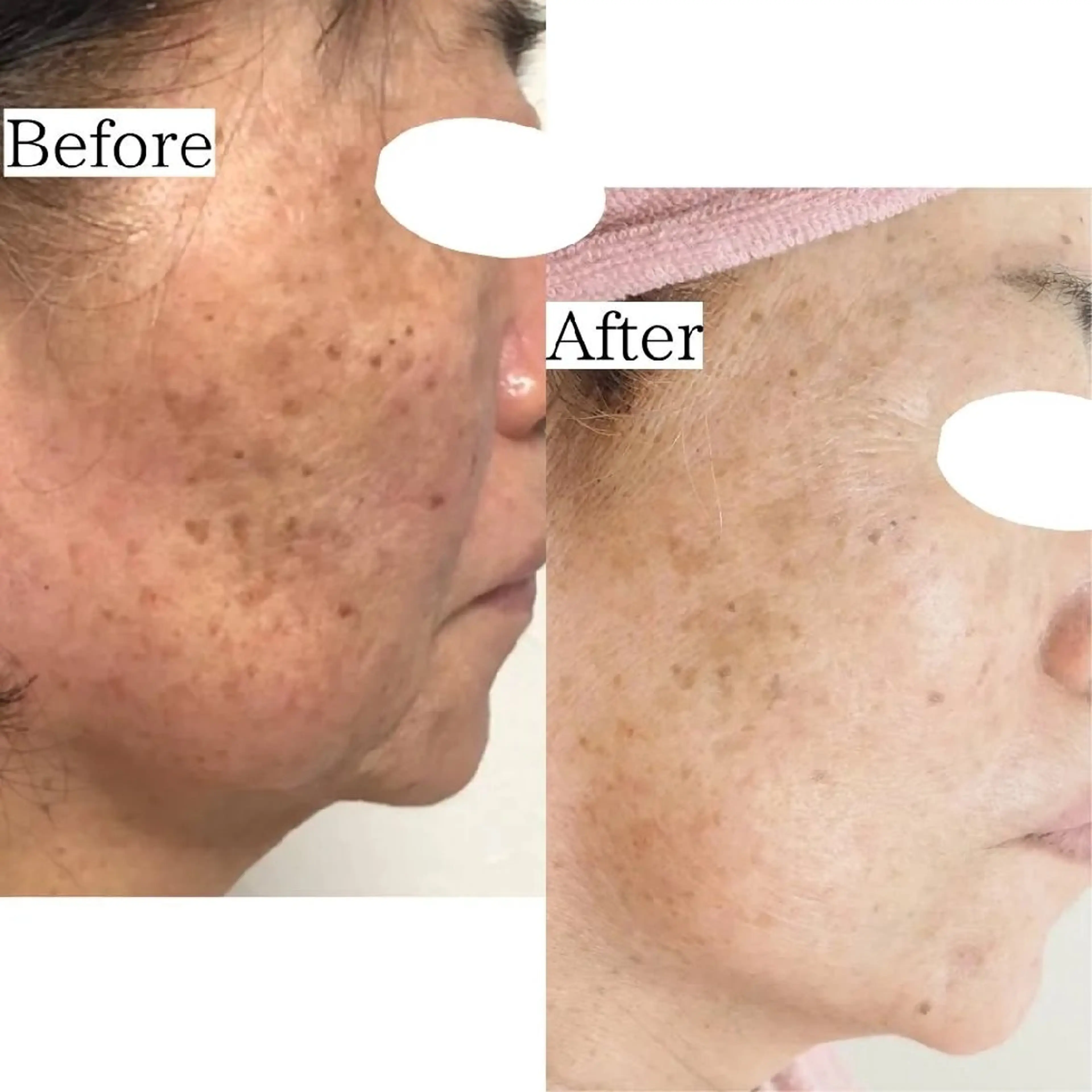 佐賀 痩身・美肌 @uni.clearのエステ・リラクイメージ