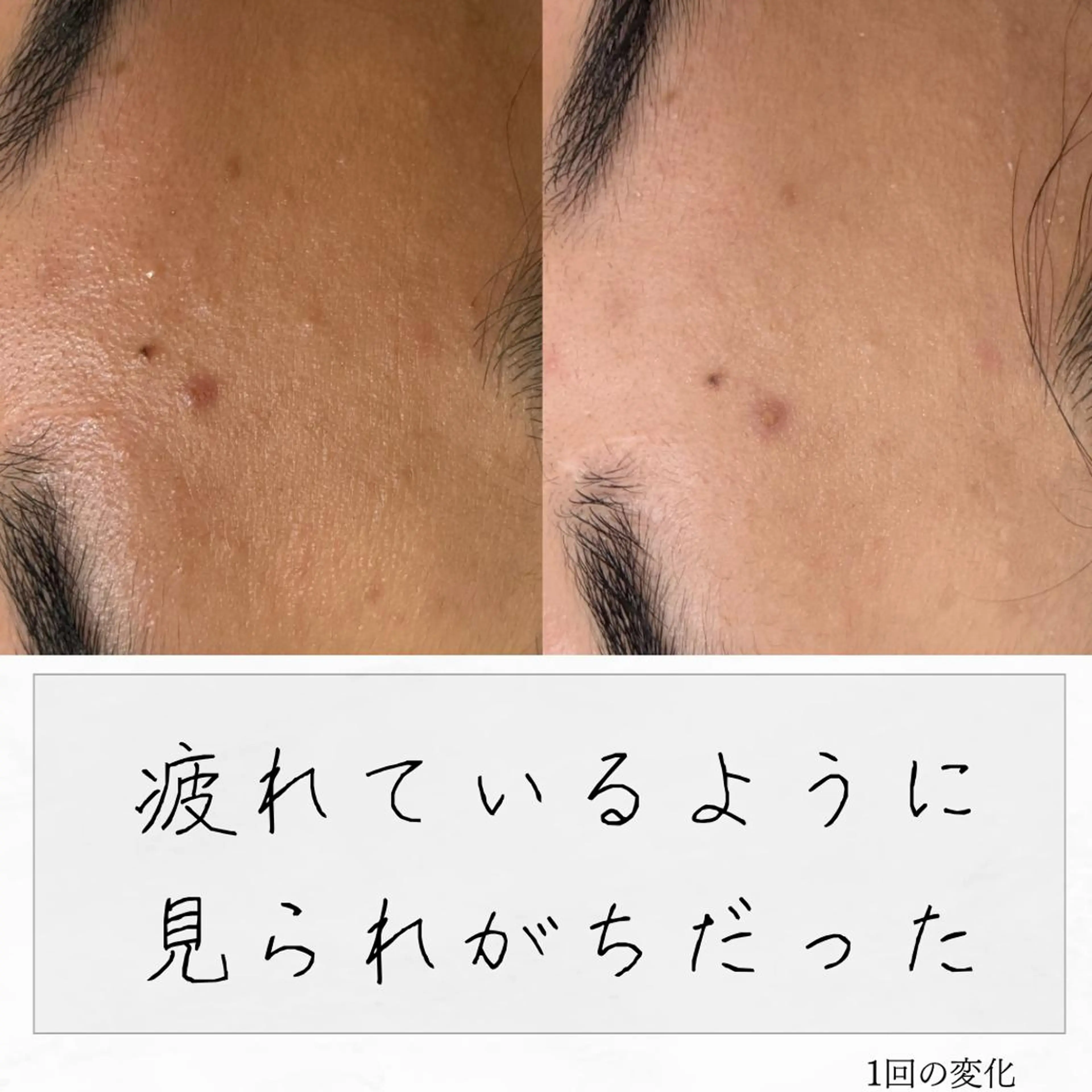 ニキビ経験者が施術 する専門サロン🌻のエステ・リラクイメージ