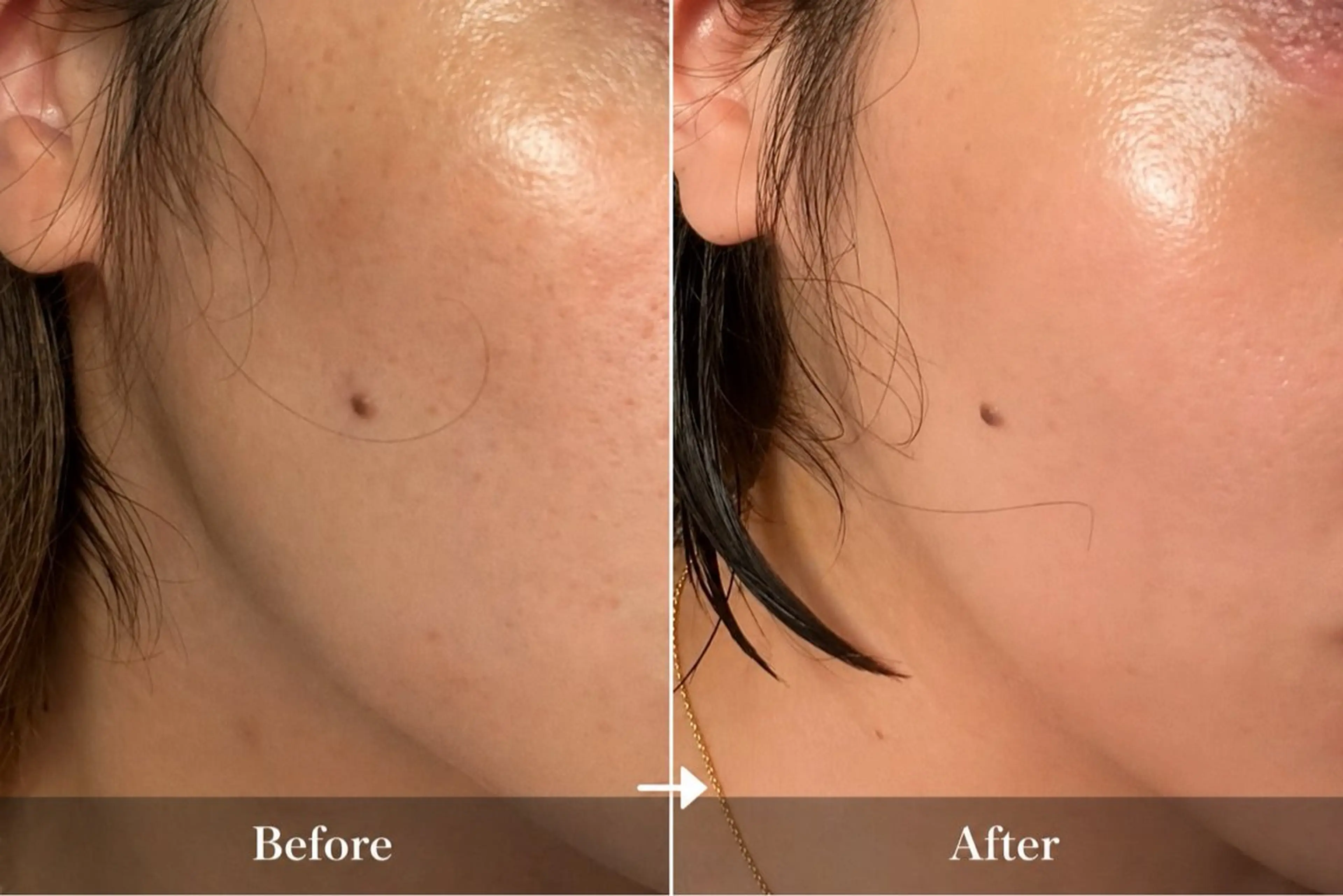 エステ レティティア秋葉原店 Yoshizawaのエステ・リラクイメージ