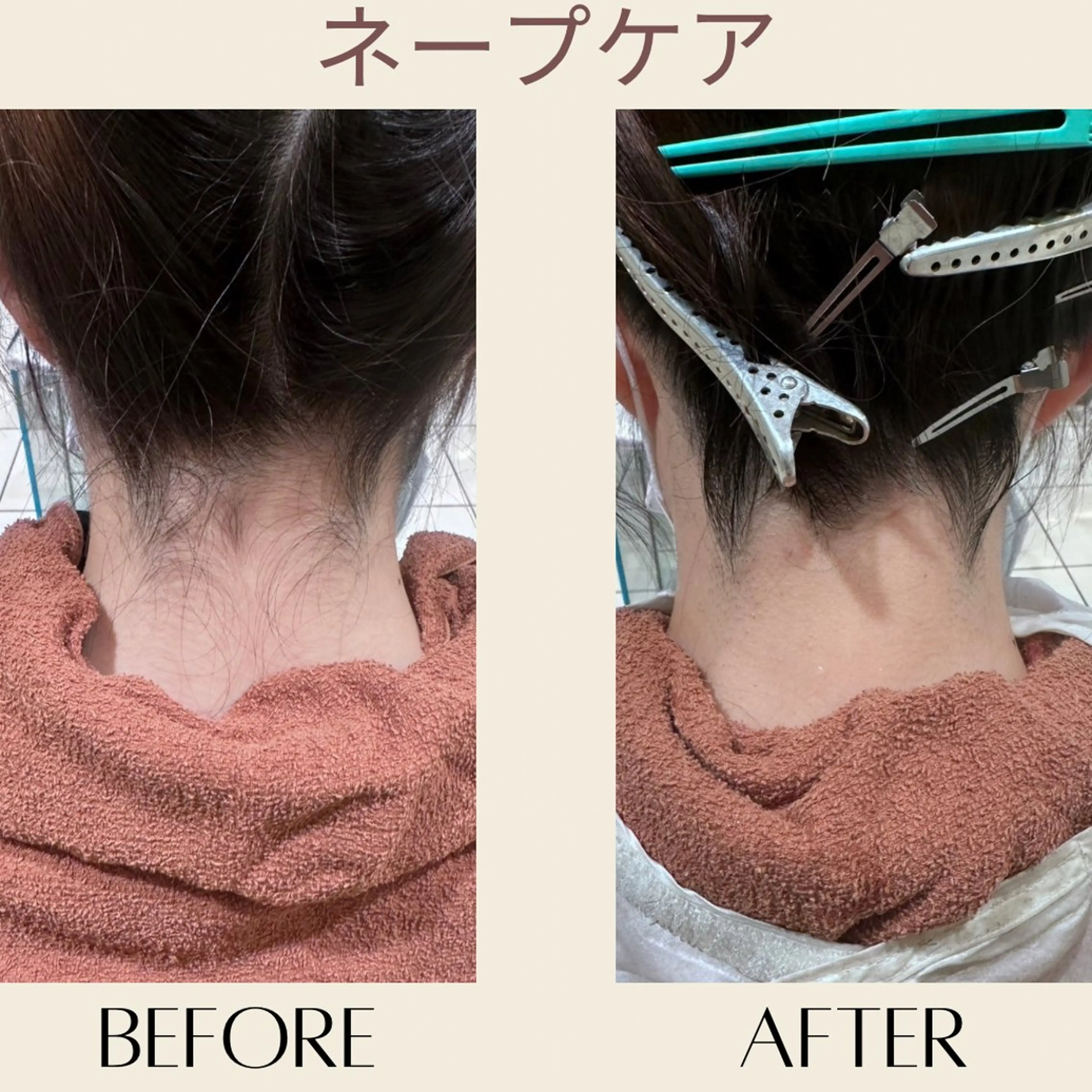 脱毛 MODE K's 白石彩夏のエステ・リラクイメージ