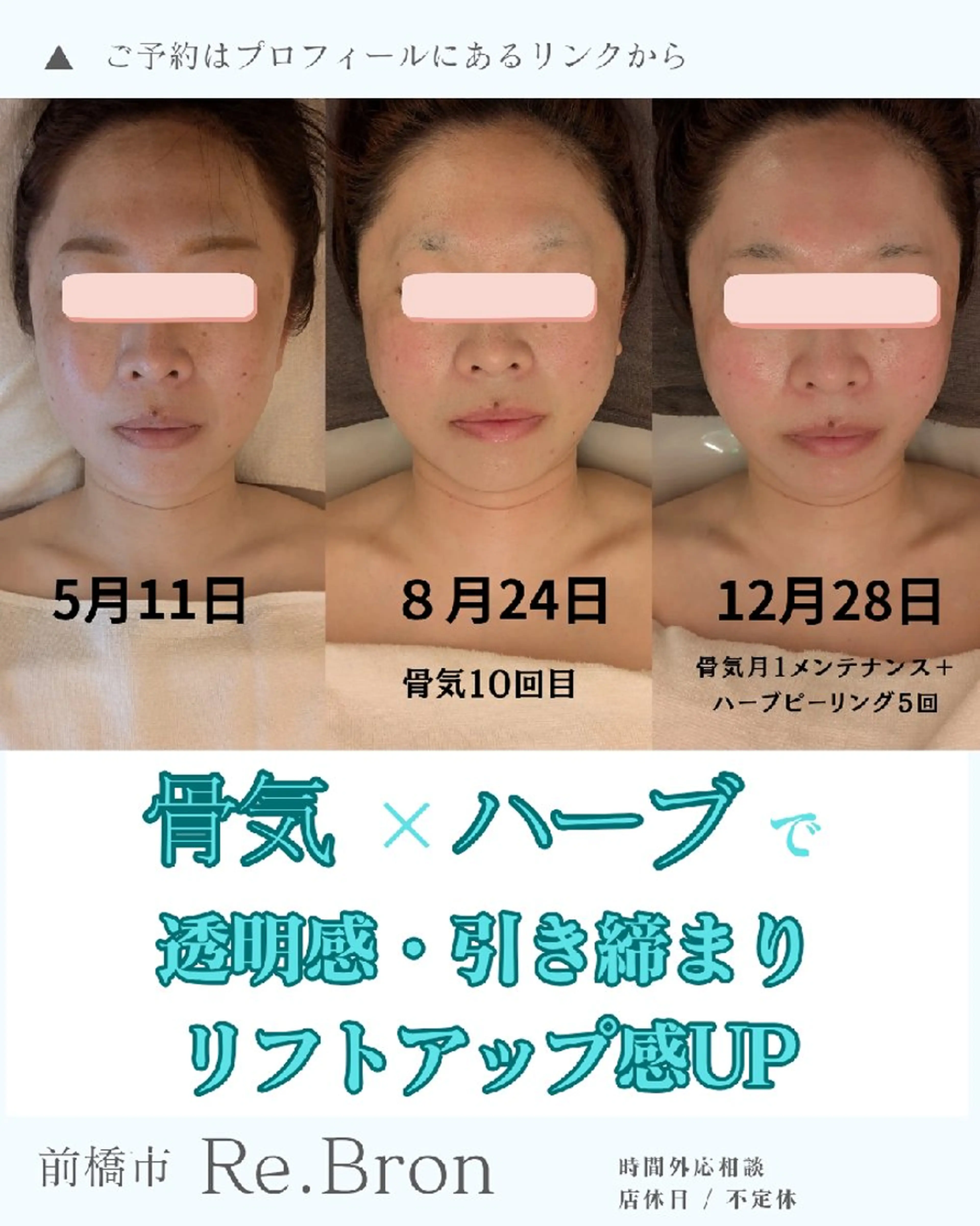 エステ リラク たるみ・ くすみ シミ・ニキビ肌改善のエステ・リラクイメージ