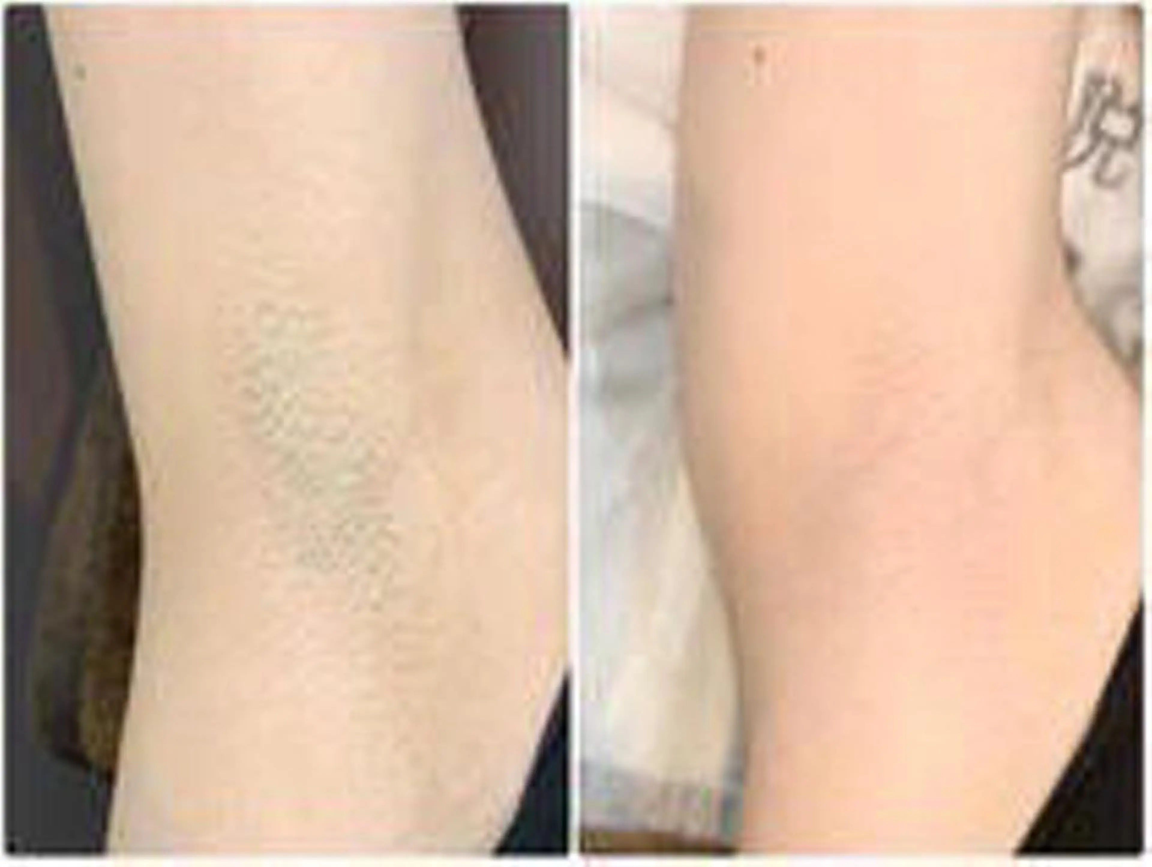 VERY VERY九条店所属・VERY VERY 🌹九条店のエステ・リラクイメージ