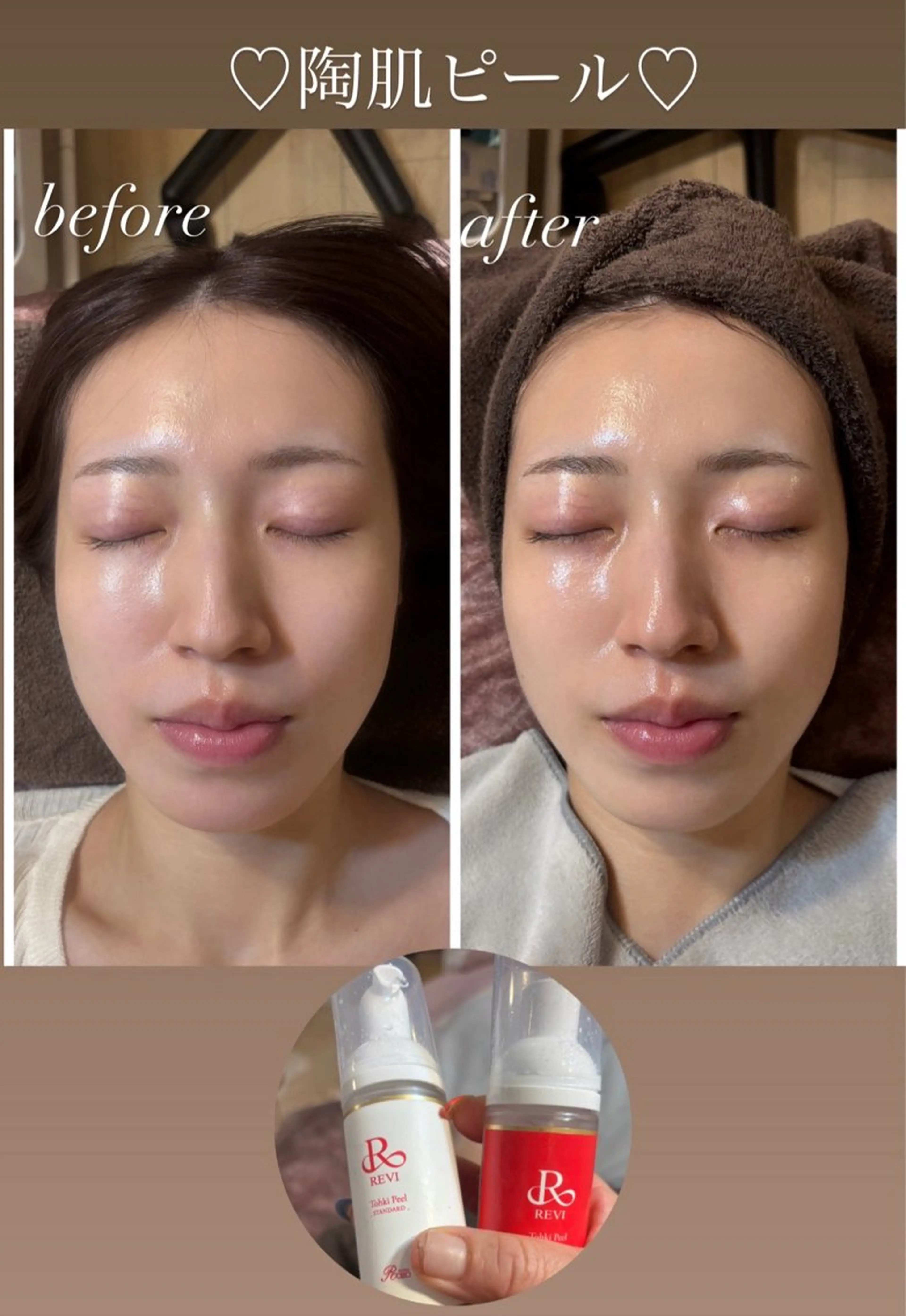 エステ ハーブピーリング専門 毛穴洗浄❤️眉waxのエステ・リラクイメージ