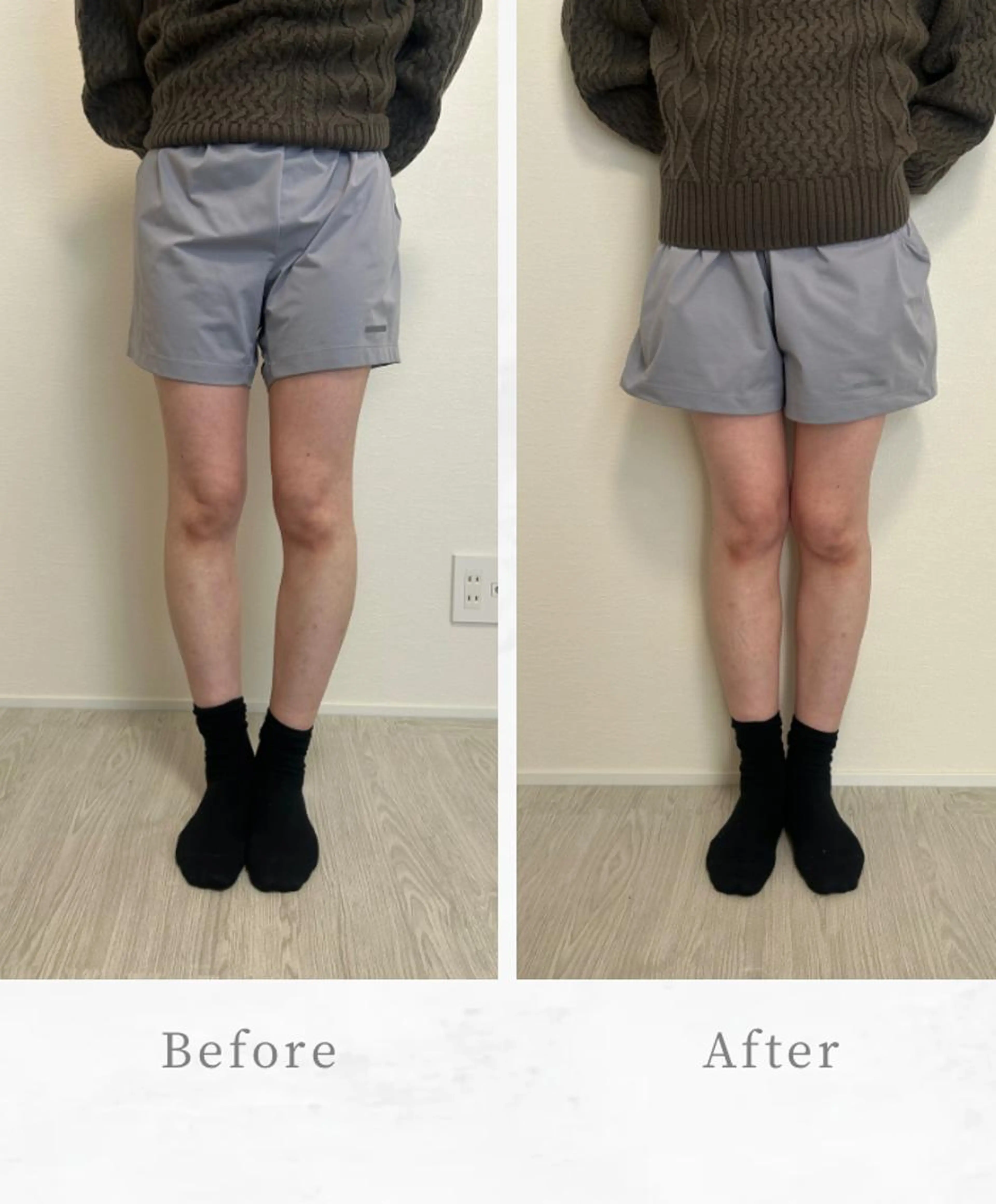 【Google 口コミ投稿♡限定価格0円】O脚矯正30分 通常8,800円→0円の写真