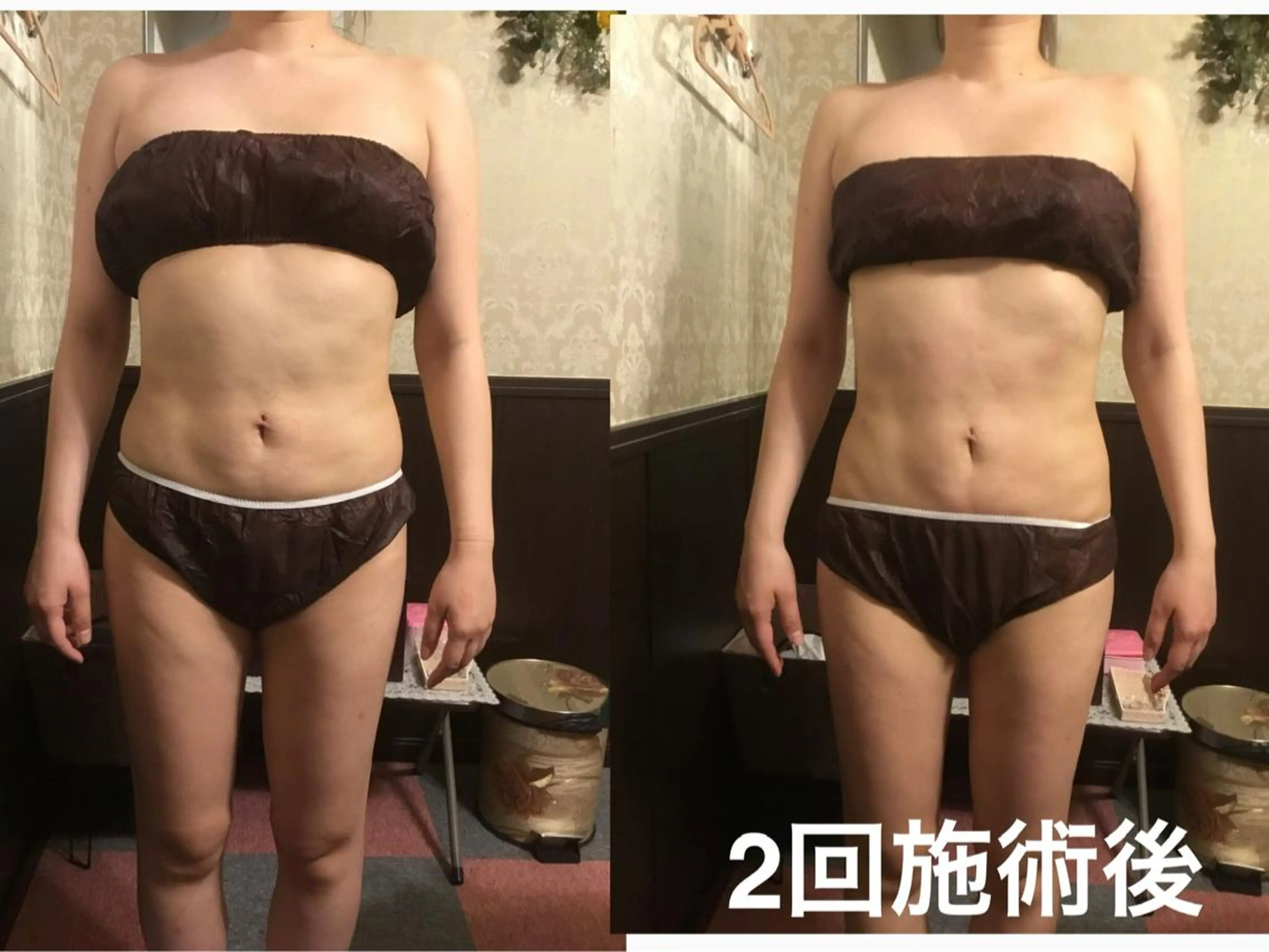 エステ エステティックサロン 凜のエステ・リラクイメージ