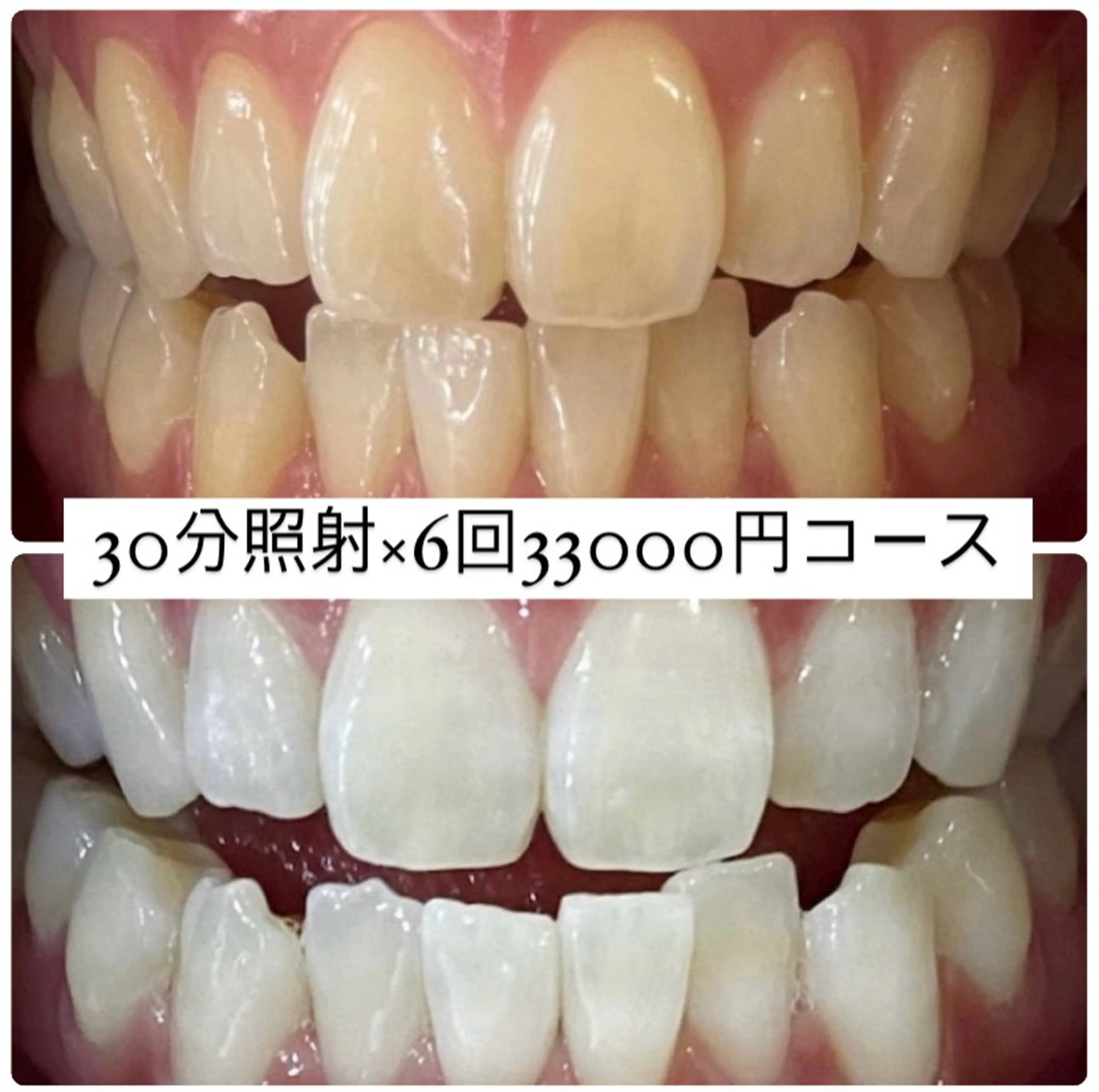 ホワイトニングルーム 横浜店のその他イメージ