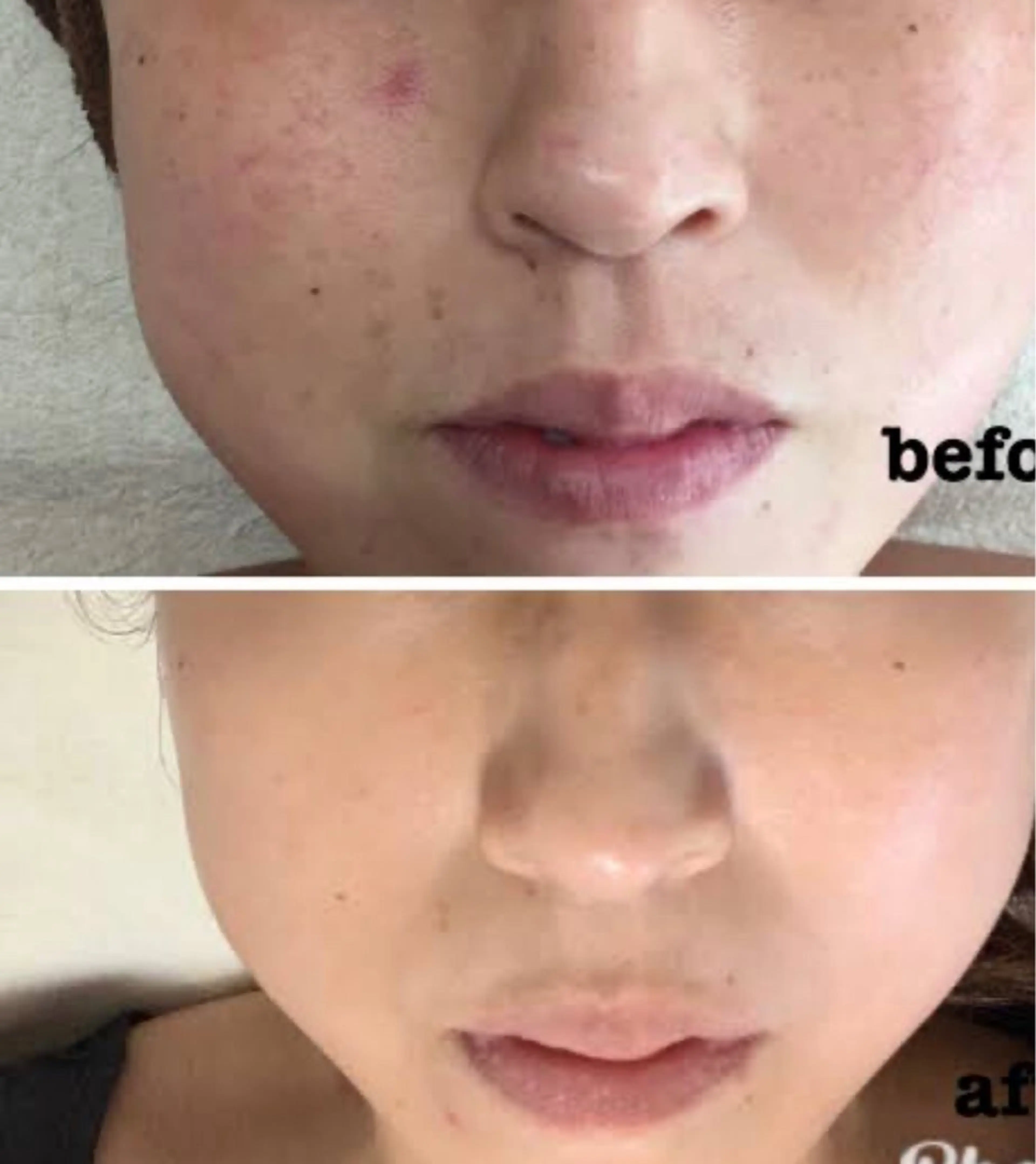 エステ ☺ハーブピール💕 ソフィアカロン💖のエステ・リラクイメージ