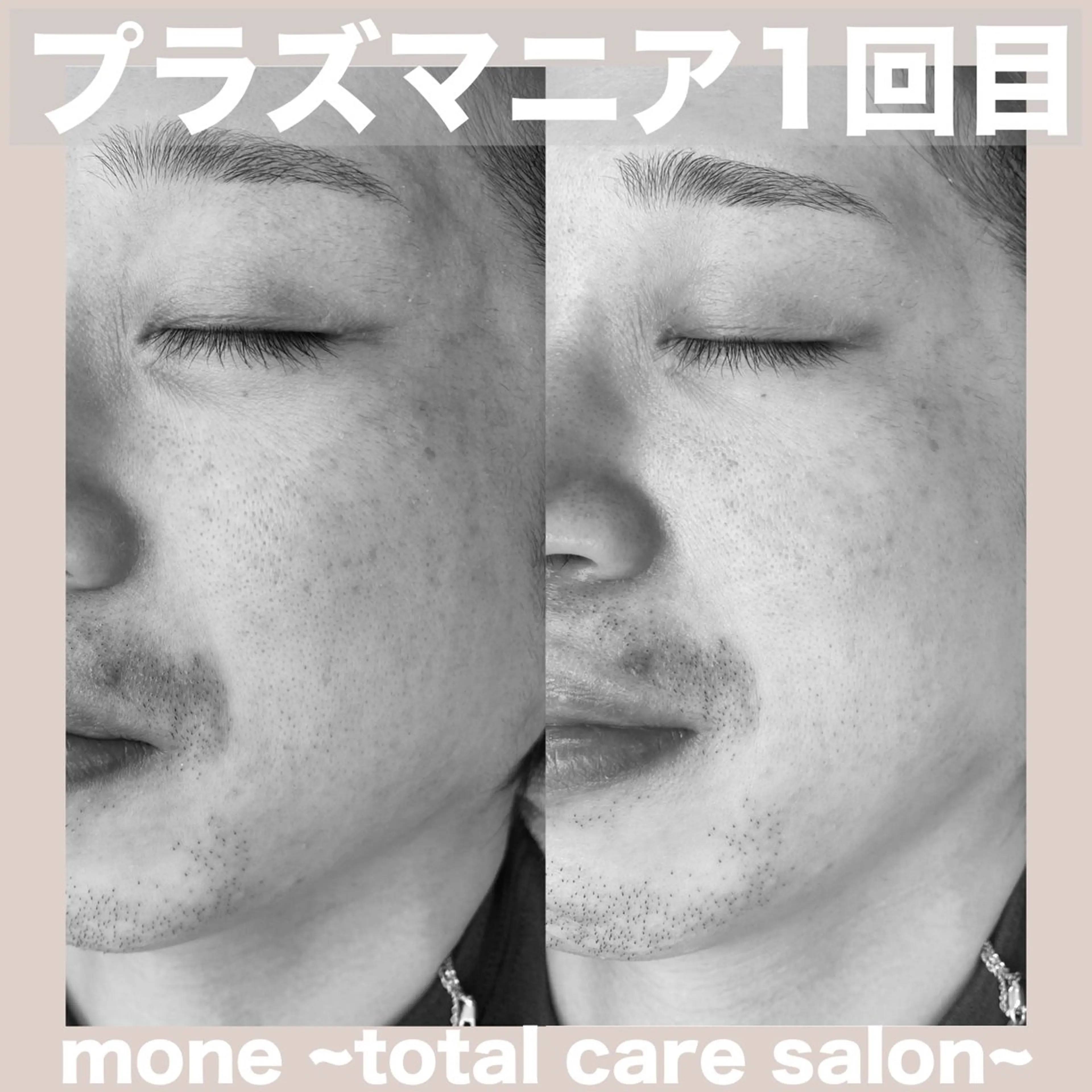 エステ mone~total care salon~所属・mone (モーネ)のエステ・リラクイメージ