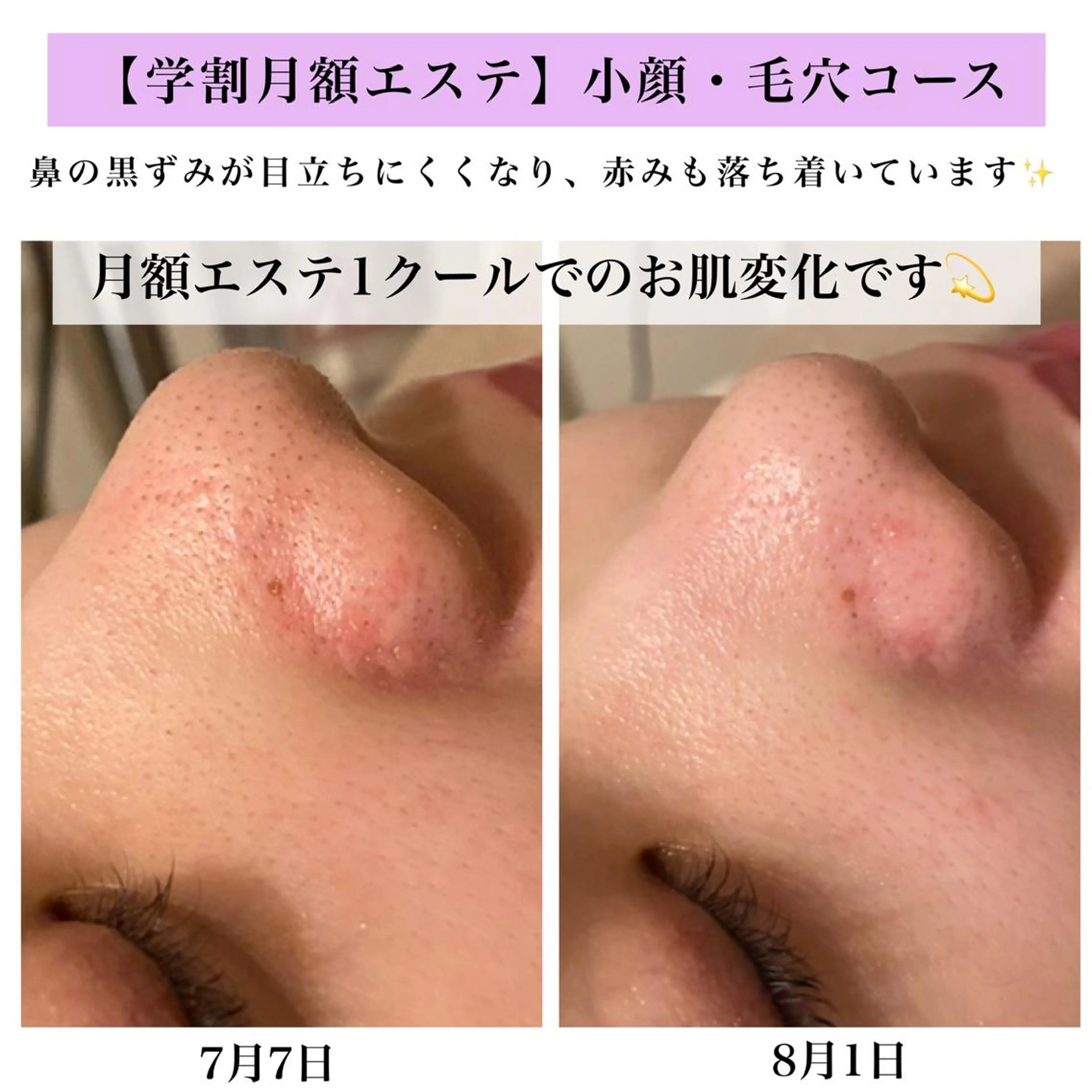 Bellesthe （ベルエステ）のエステ・リラクイメージ