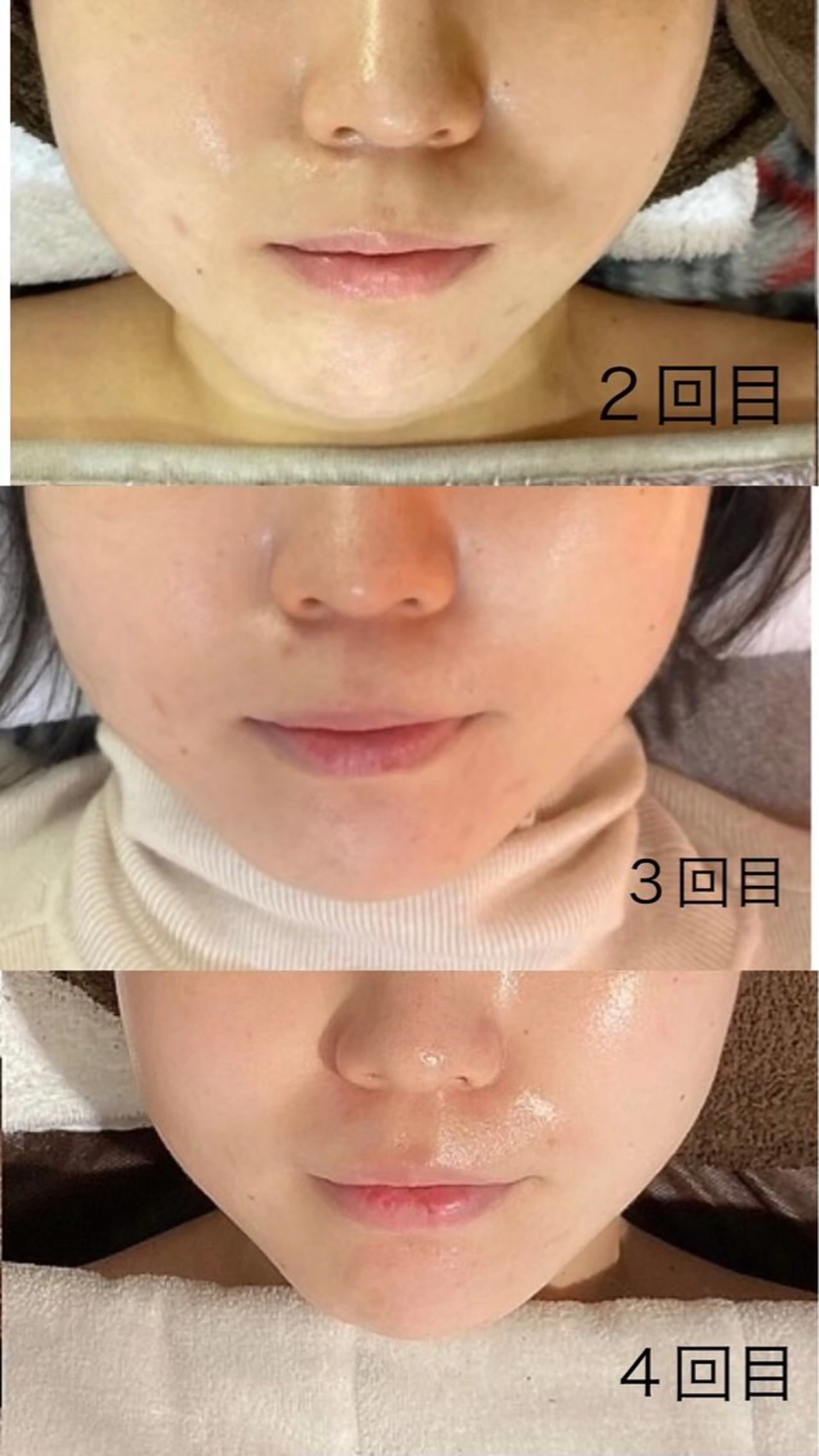 エステ 肌質改善サロン La Divinaのエステ・リラクイメージ