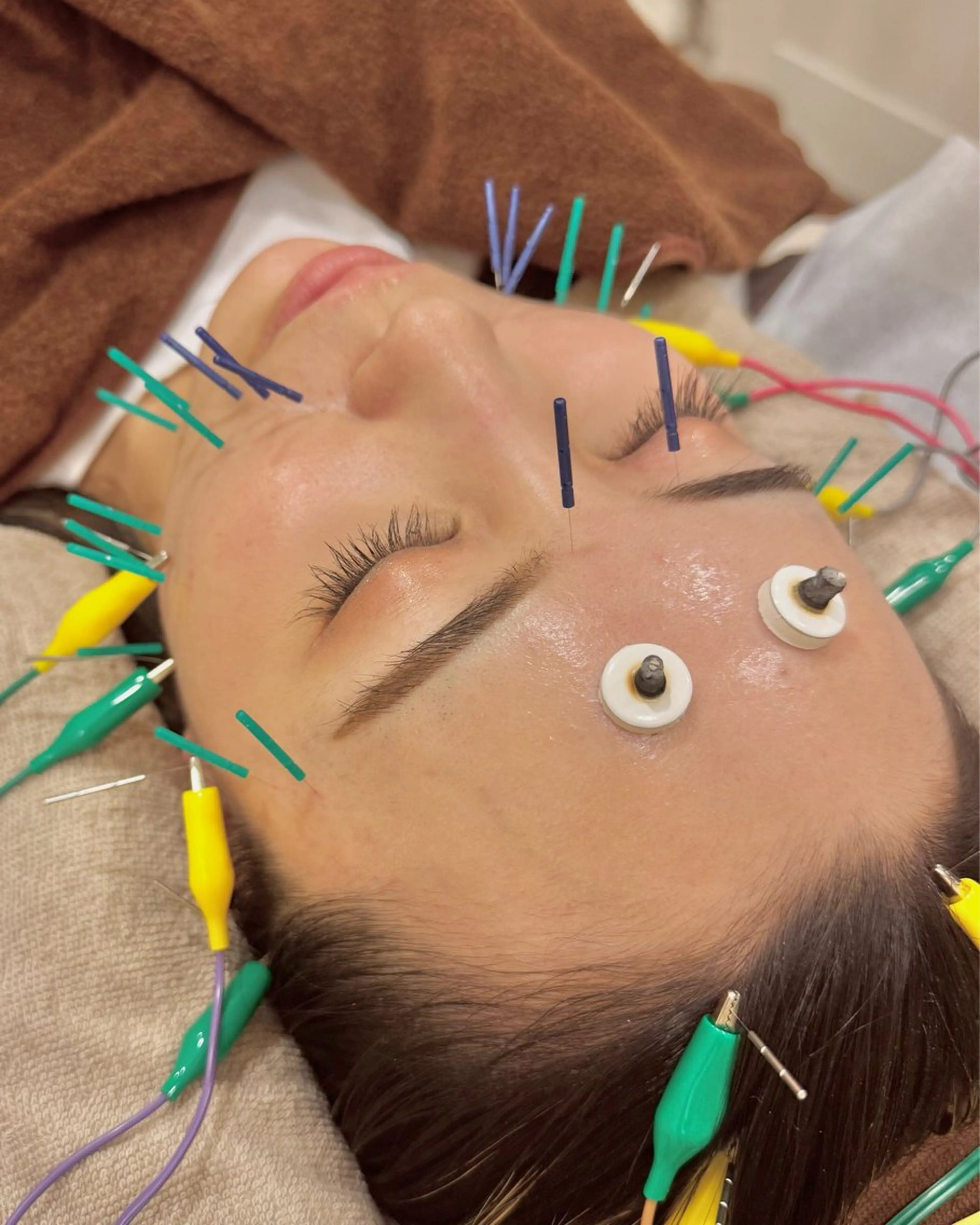 Ayaka🤍 恵比寿/美容鍼/整体のエステ・リラクイメージ