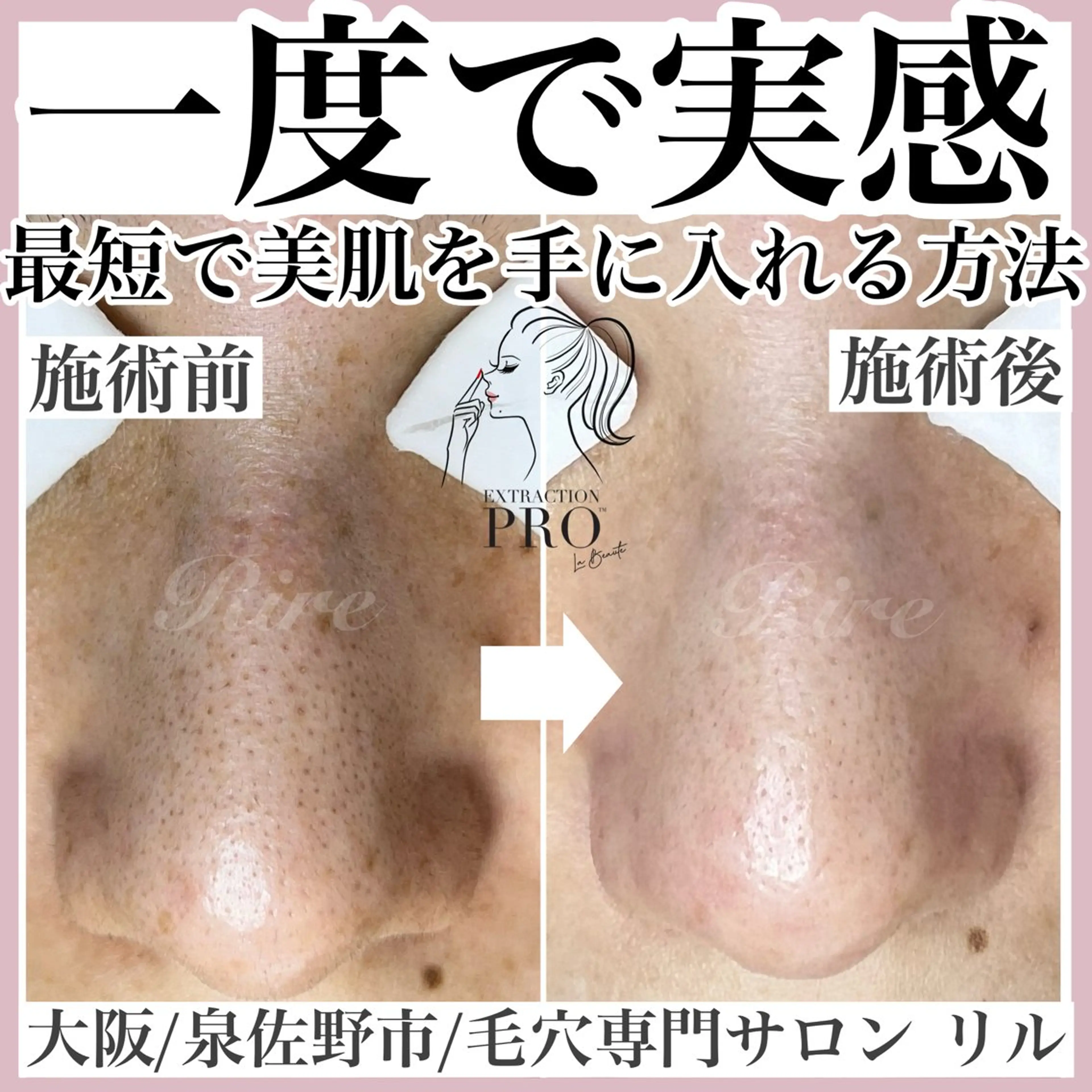 エステ 隅田 都布子のマツエク・マツパデザイン