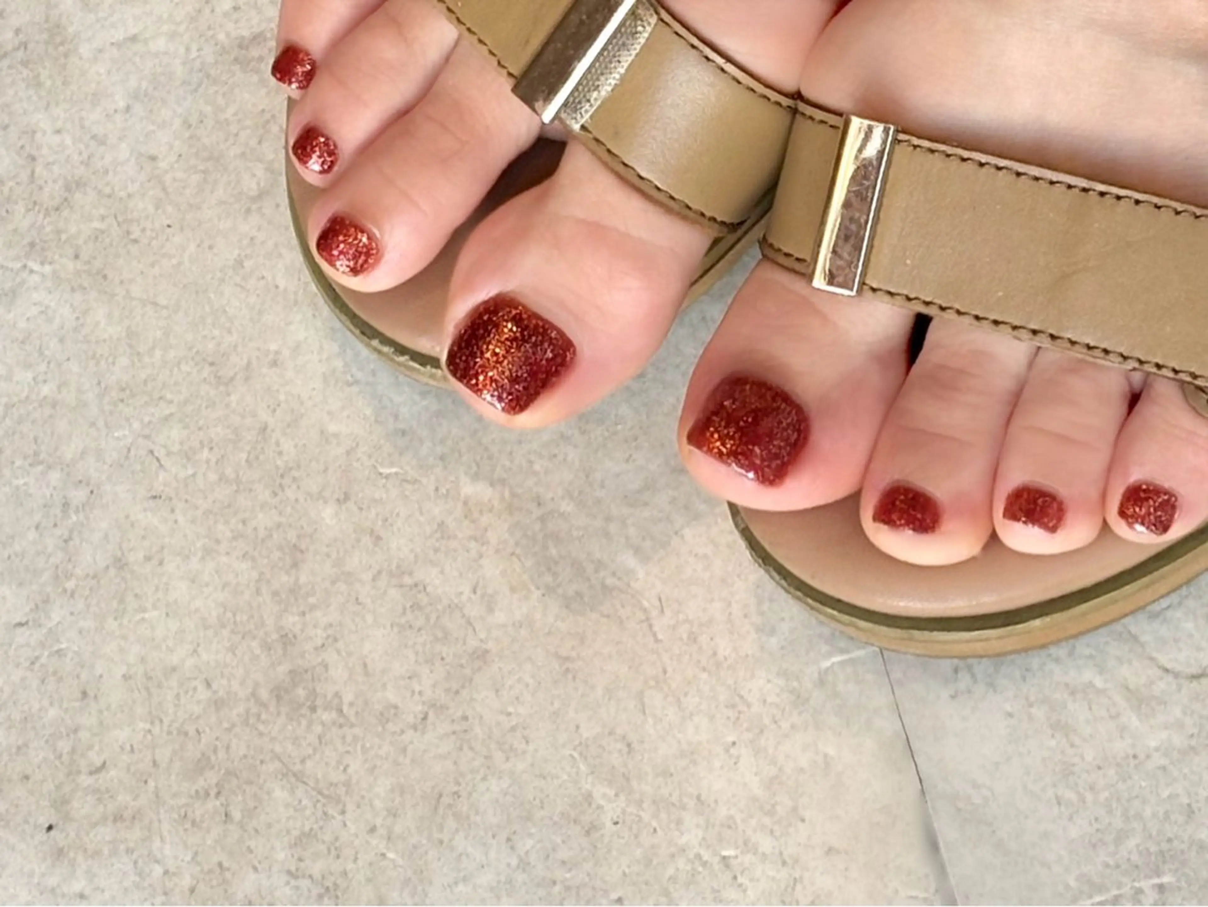 巻爪補正＋フットジェルワンカラーの写真