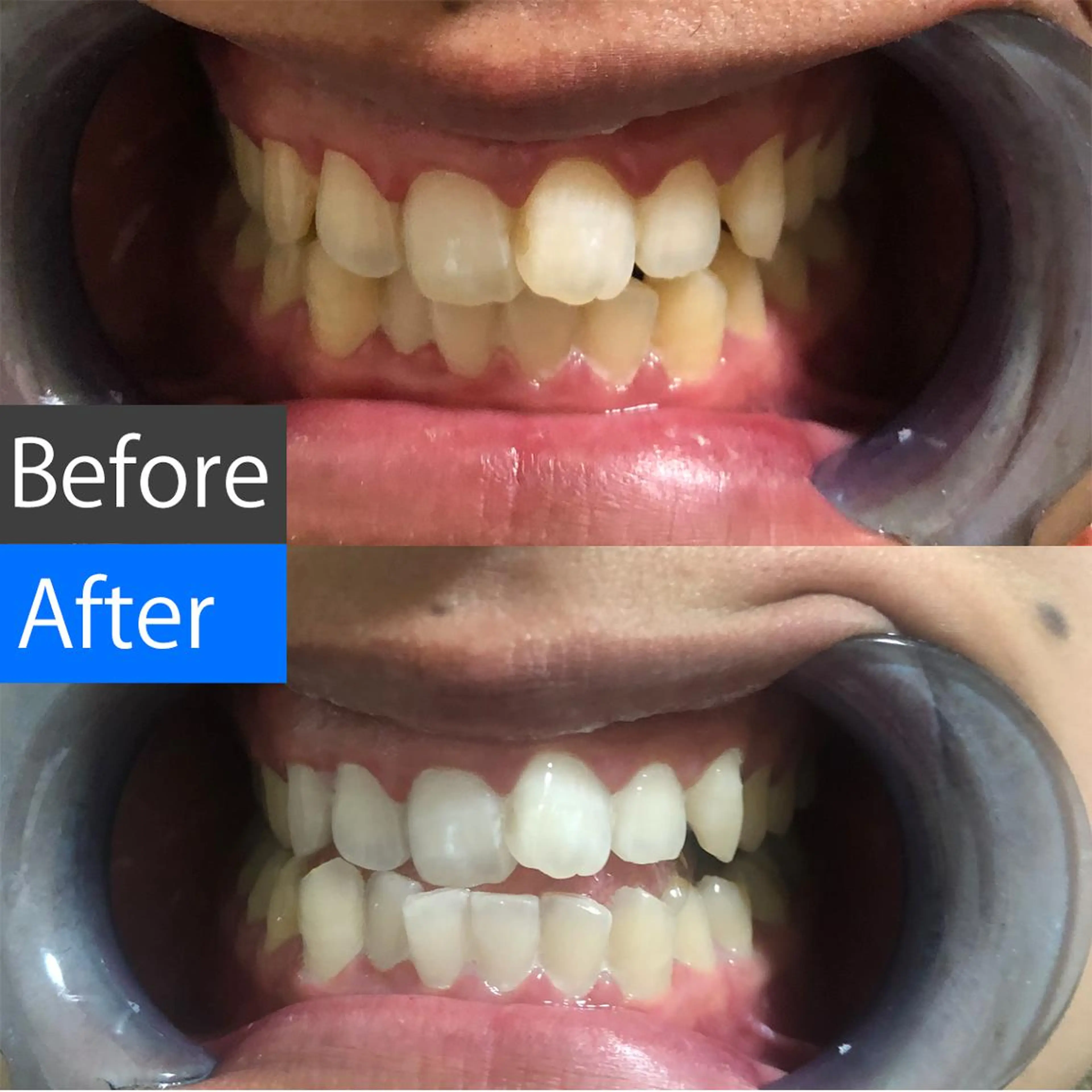 ショート パーマ マツエク・マツパ アイブロウ ヘアアレンジ メンズ キッズ ネイル カラー 結婚式・ブライダル メンズ就活ヘア 結婚式・ブライダル オフィスネイル ブライダルネイル 中目黒 ホワイトニングサロンのその他イメージ