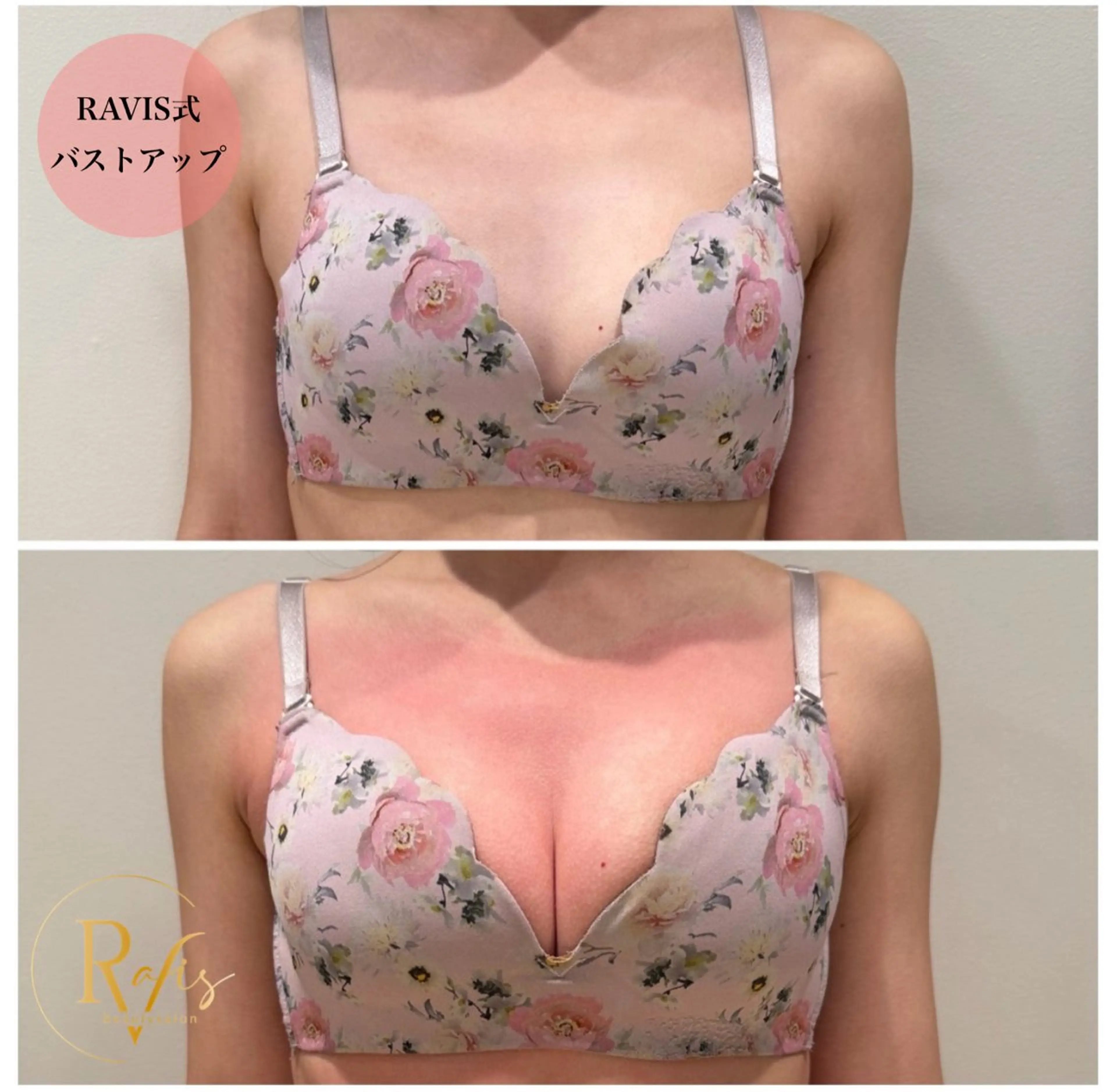 東大阪/韓国肌管理/ 痩身バスト専門店のエステ・リラクイメージ