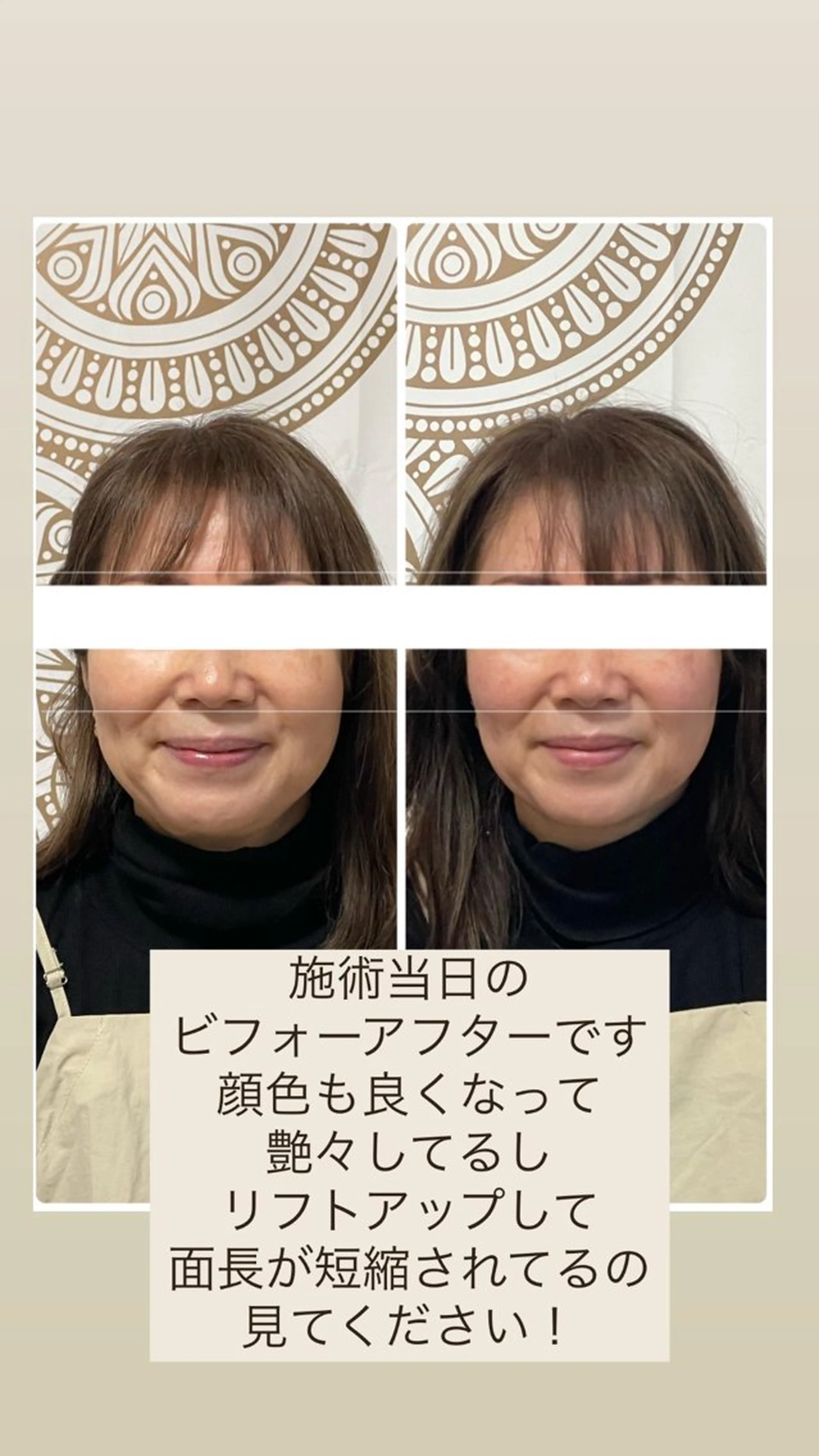 あだち整体エステ 首肩背中のゆるめぐのエステ・リラクイメージ