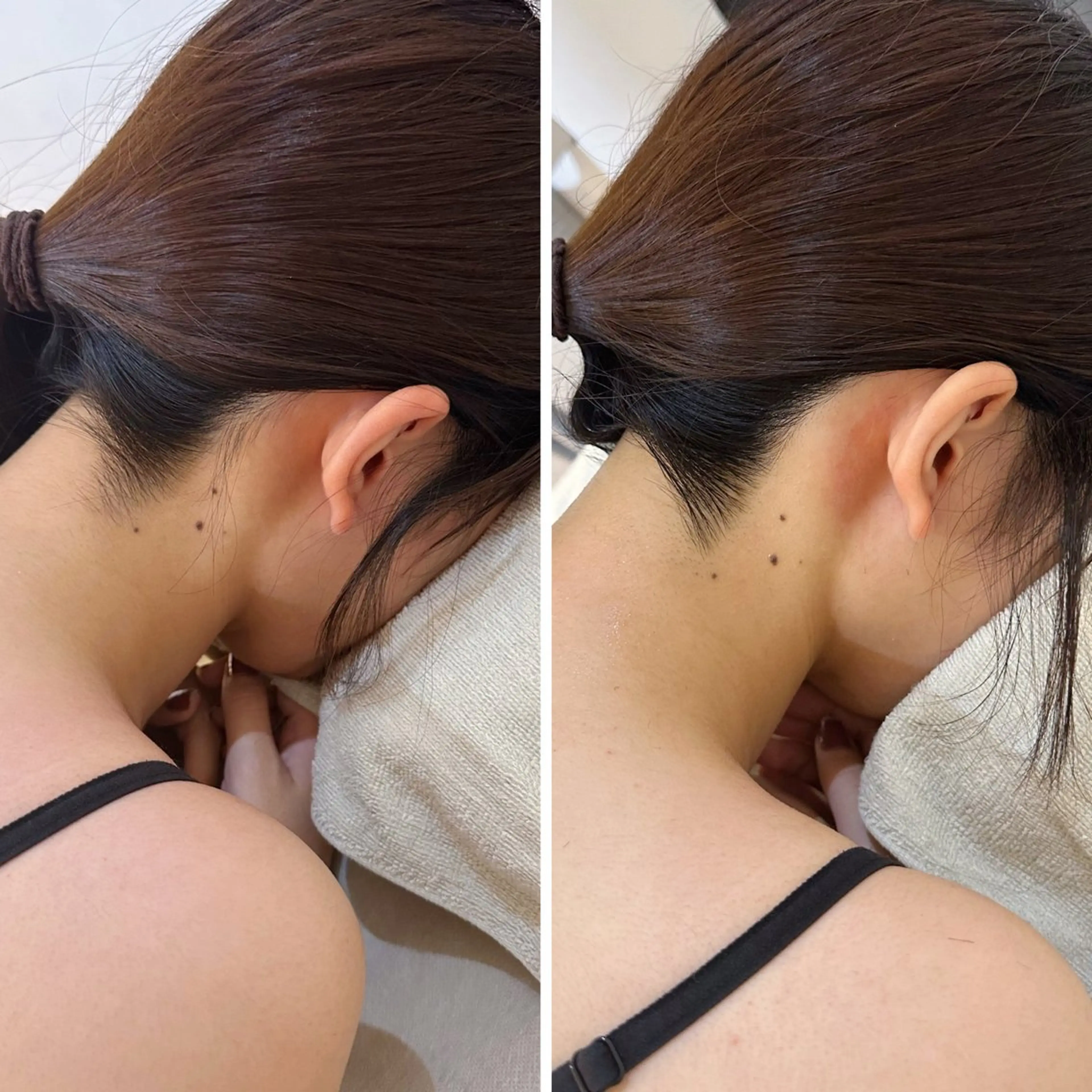 脱毛 うなじ脱毛/美肌脱毛 LABELのエステ・リラクイメージ