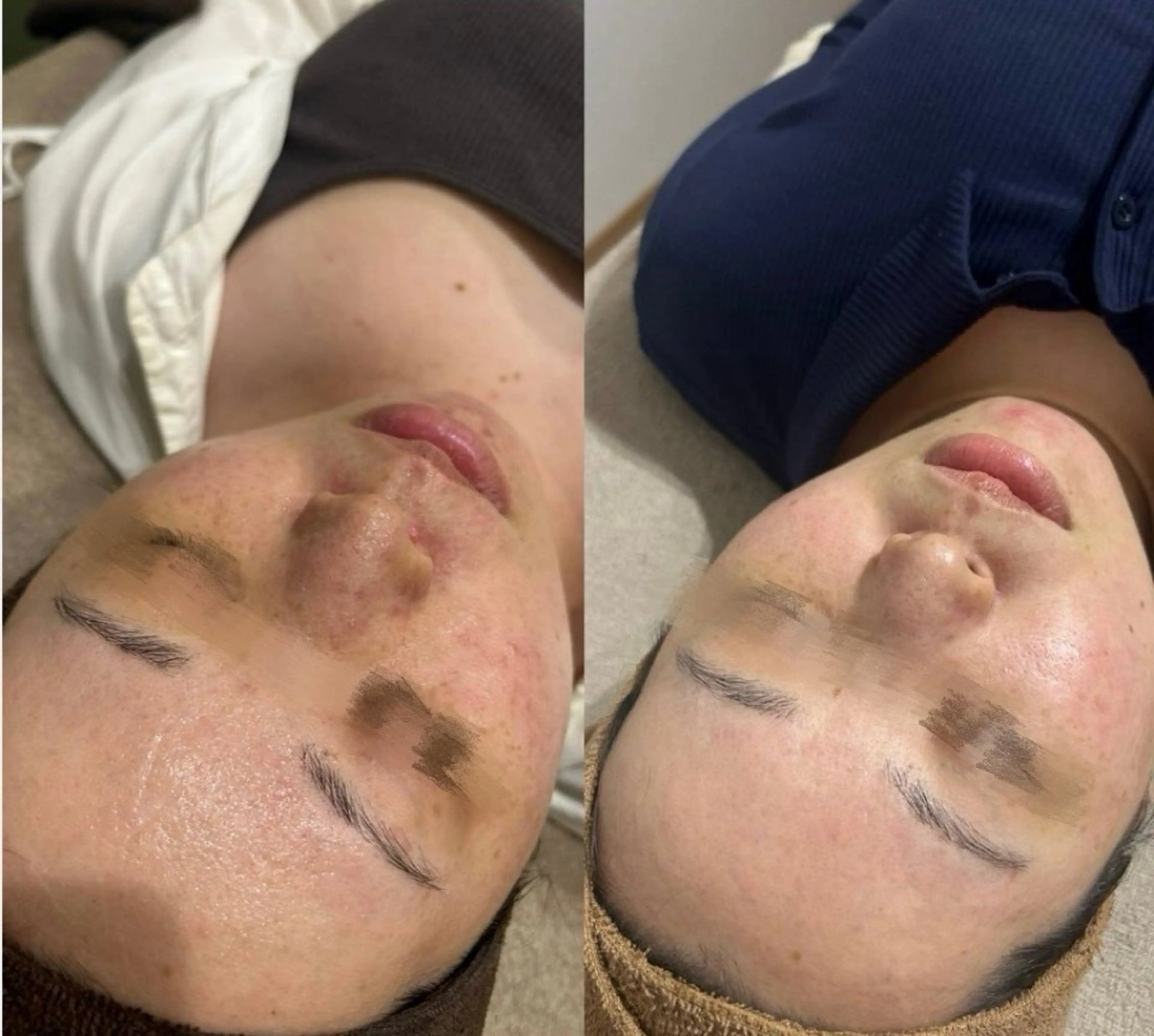 LUMIERE(ルミエル)福岡春吉店所属・LUMIERE 福岡のエステ・リラクイメージ