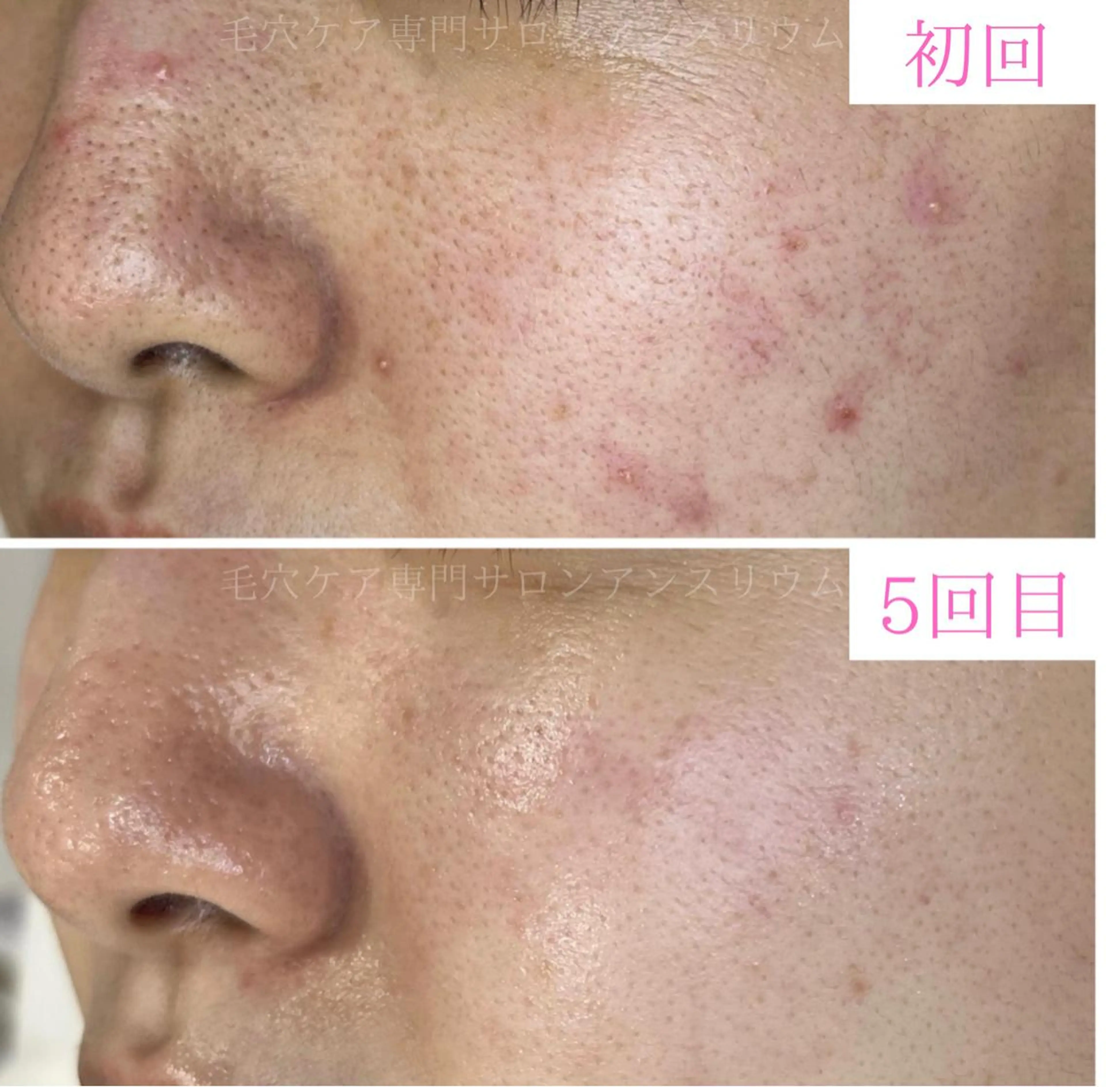 茨城土浦 つくば毛穴 ケア専門サロンのエステ・リラクイメージ