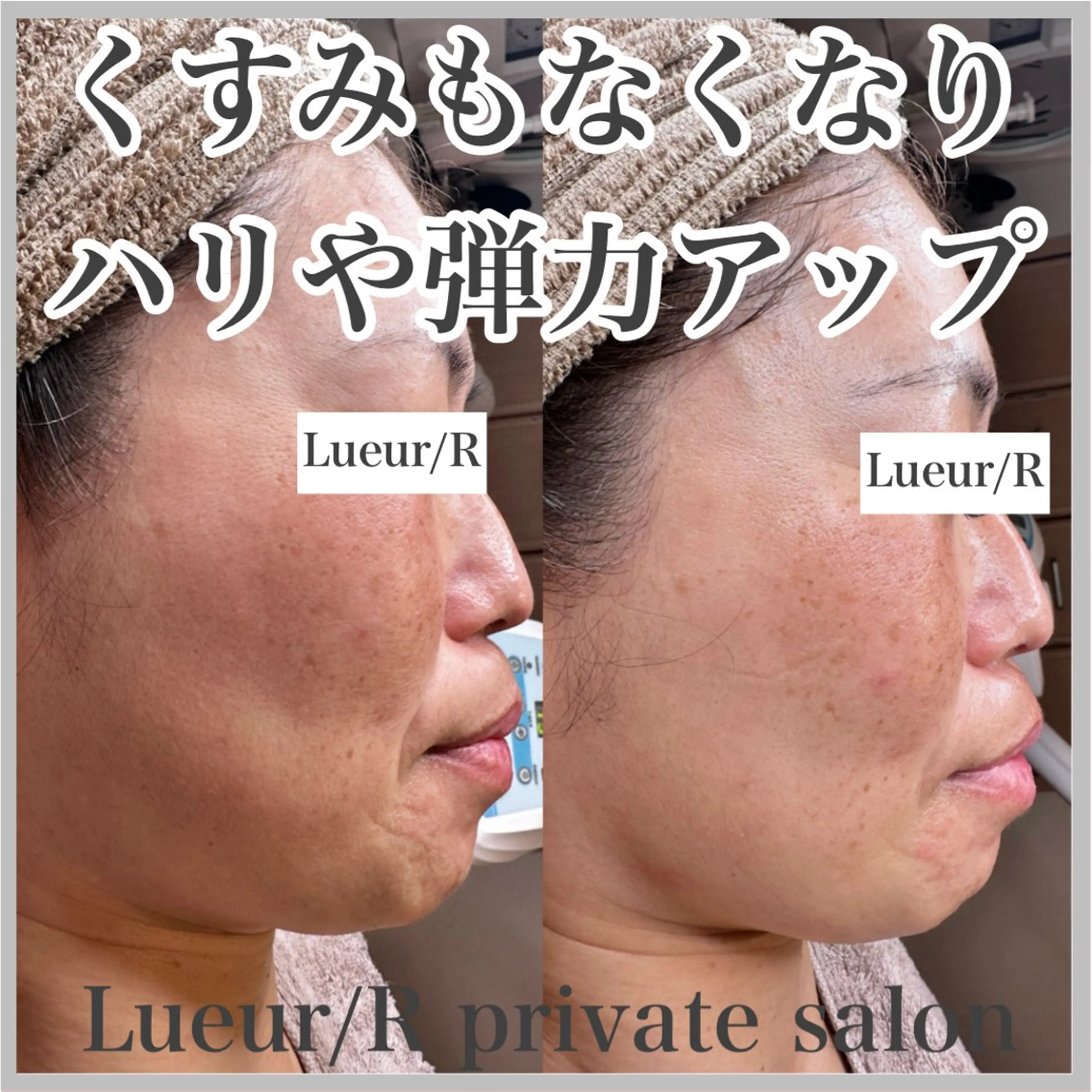 エステ 大久保 里奈のエステ・リラクイメージ