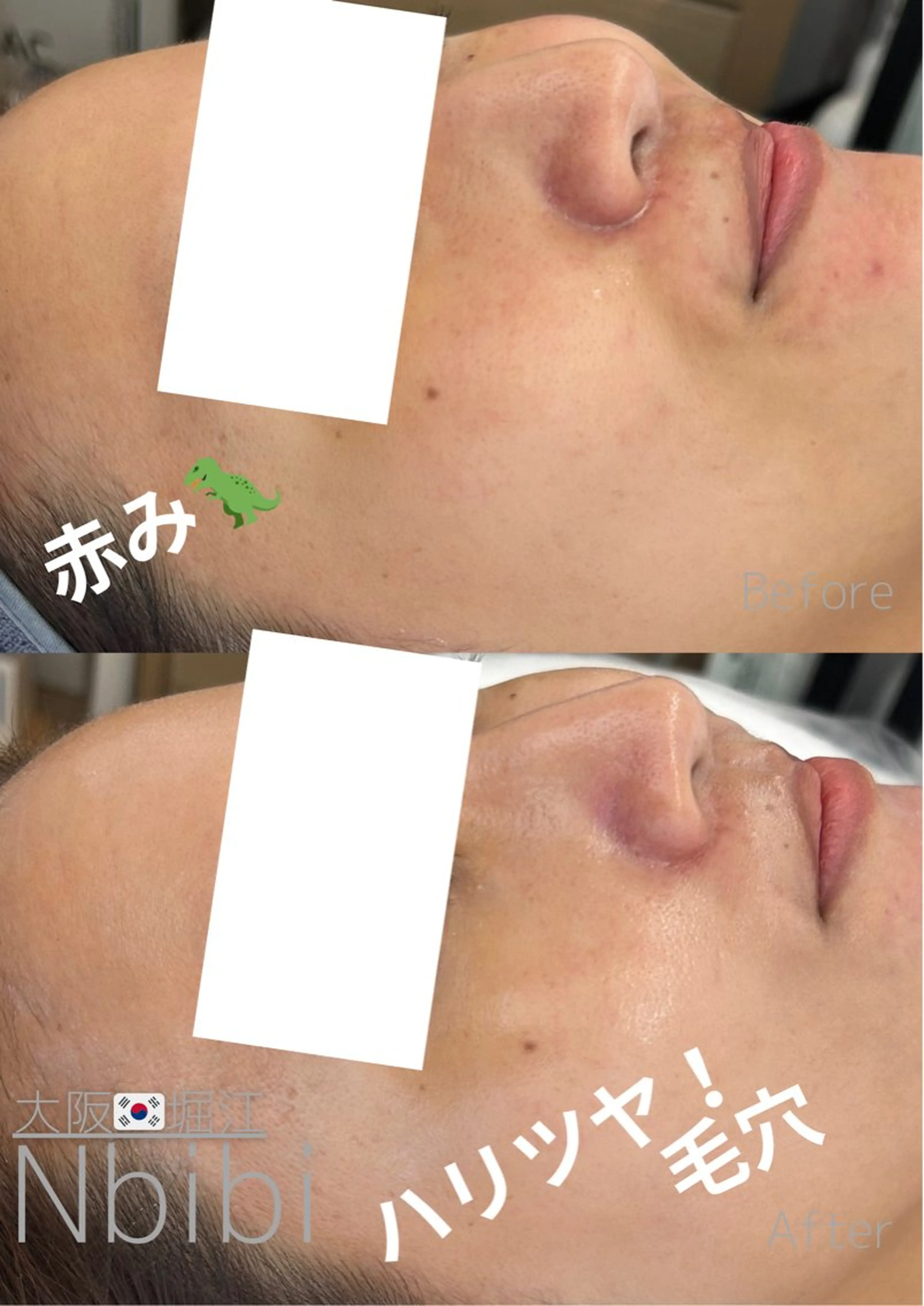 エステ 韓国🇰🇷価格 サロン_Nbibiの眉毛・アイブロウイメージ