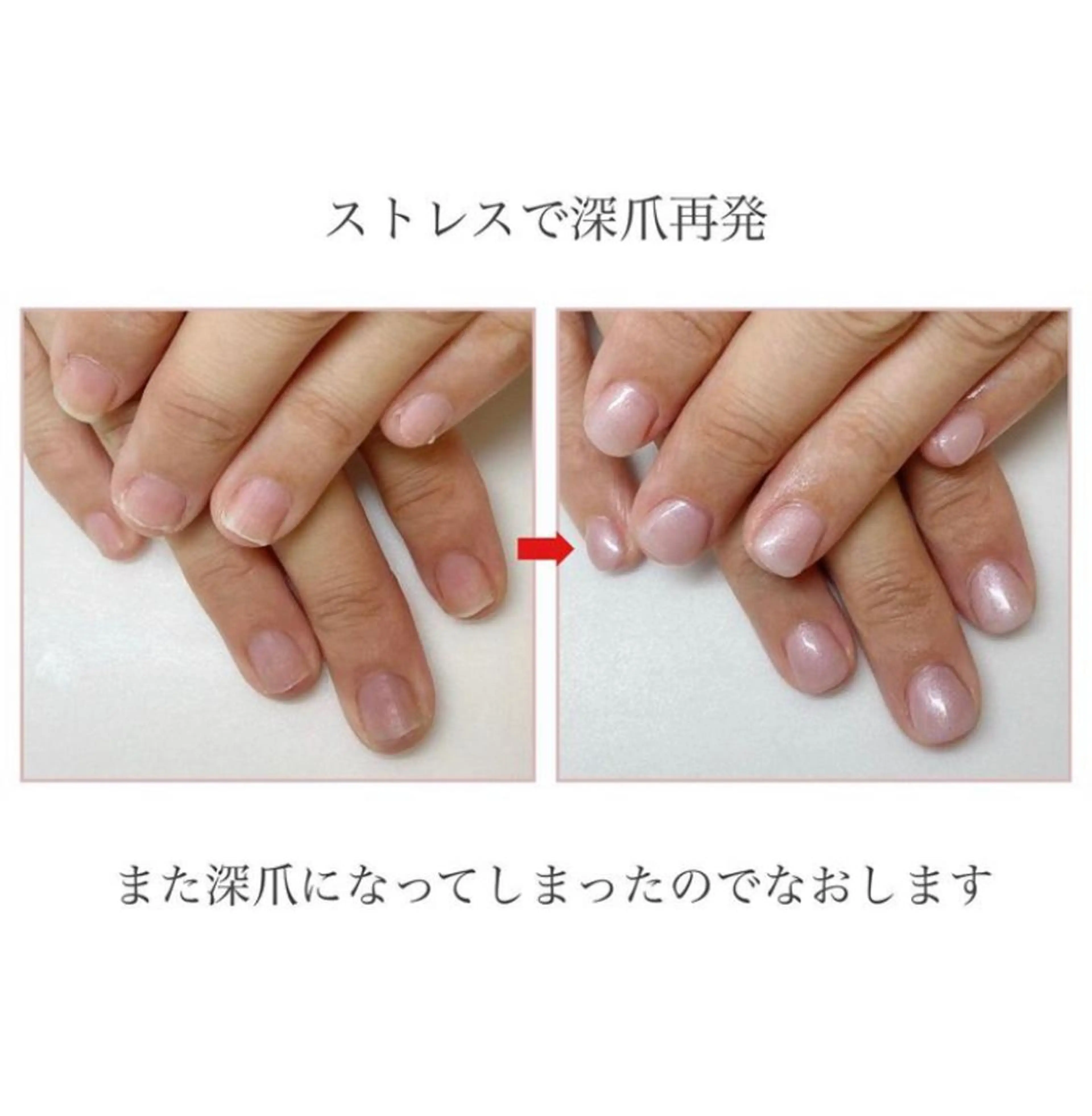 ネイル ネイルサロン アリュームのネイルデザイン