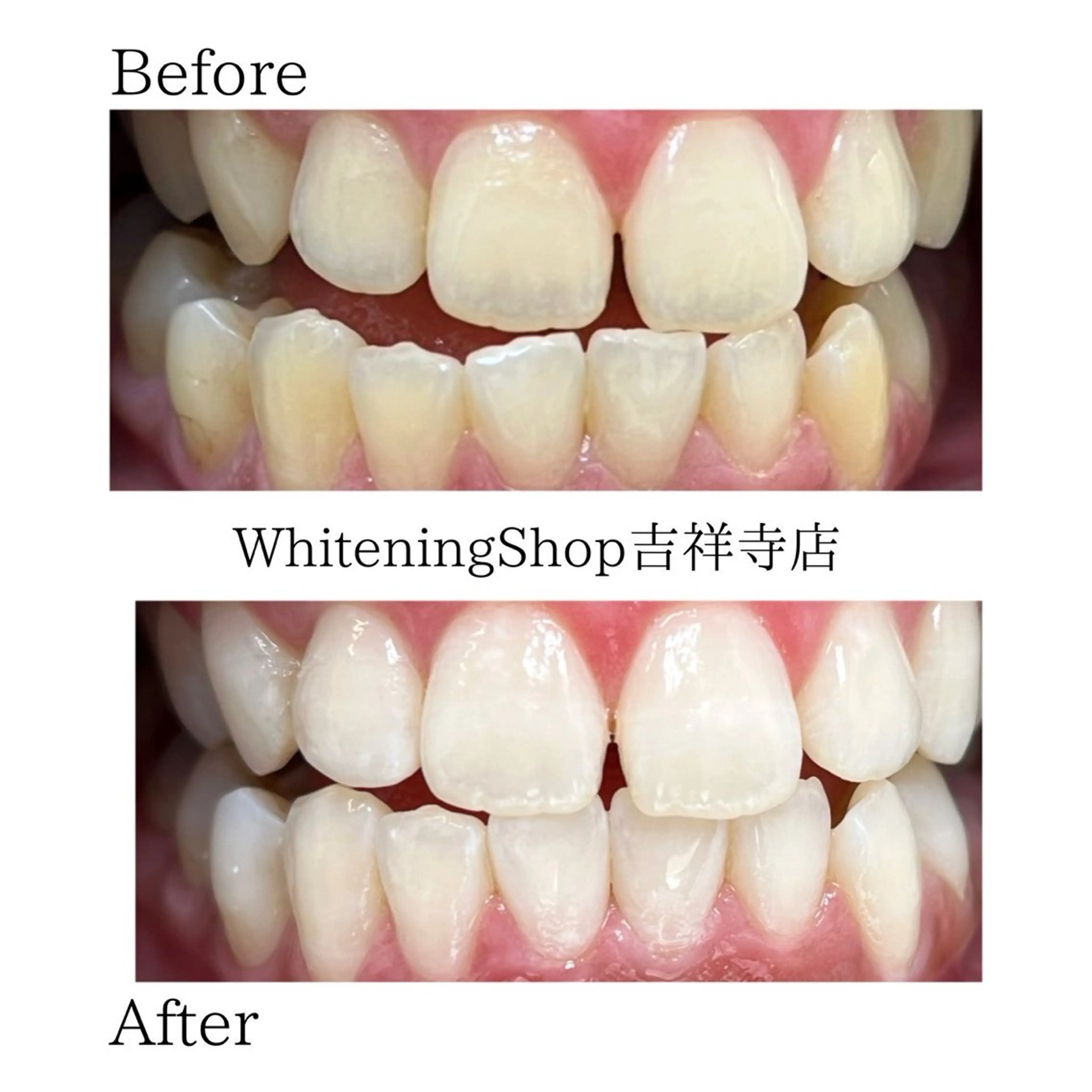 エステ リラク ホワイトニング ショップ吉祥寺店のエステ・リラクイメージ